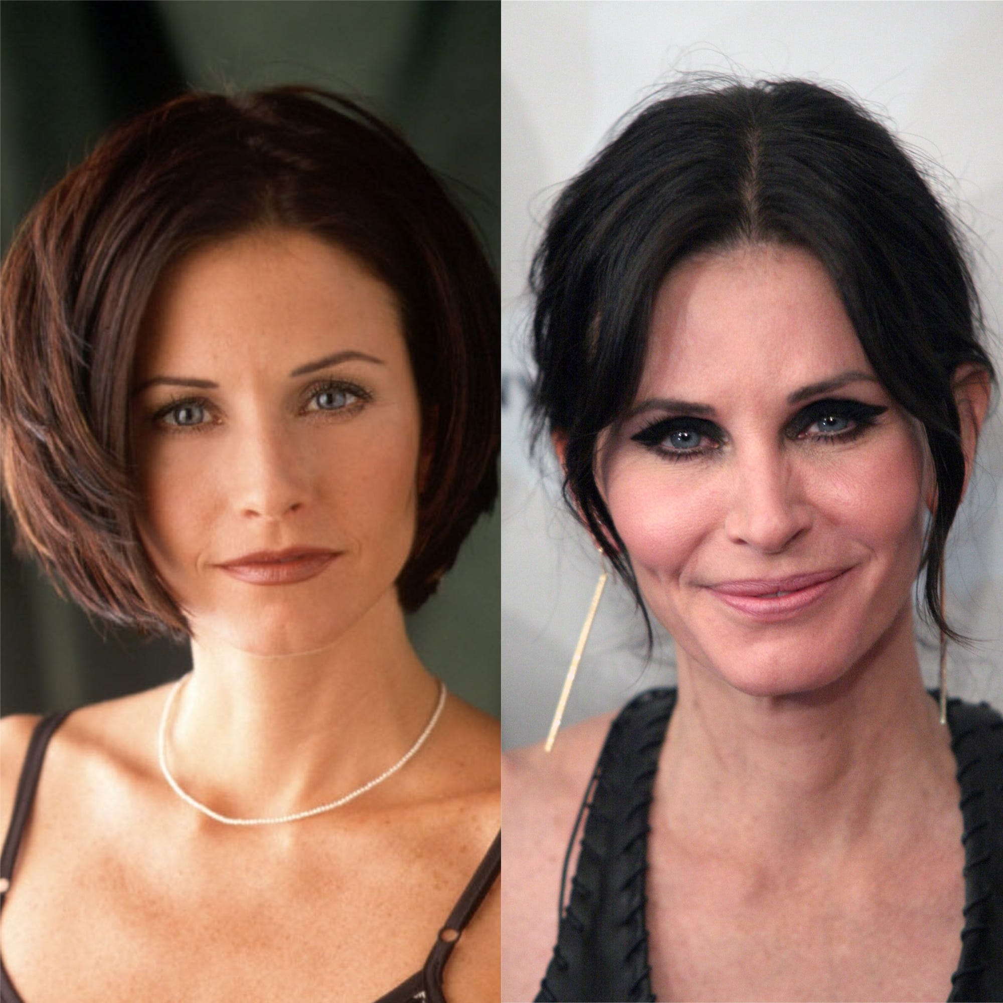Courteney Cox Face Surgery