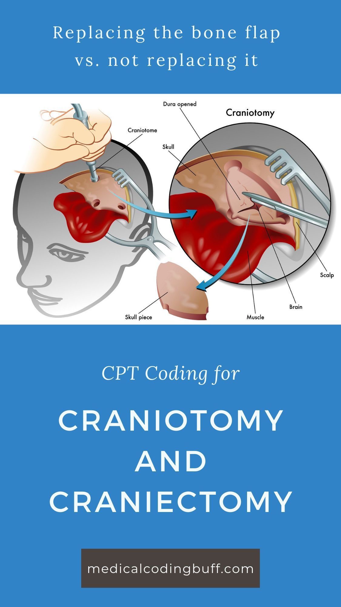 Craniectomy Vs Craniotomy