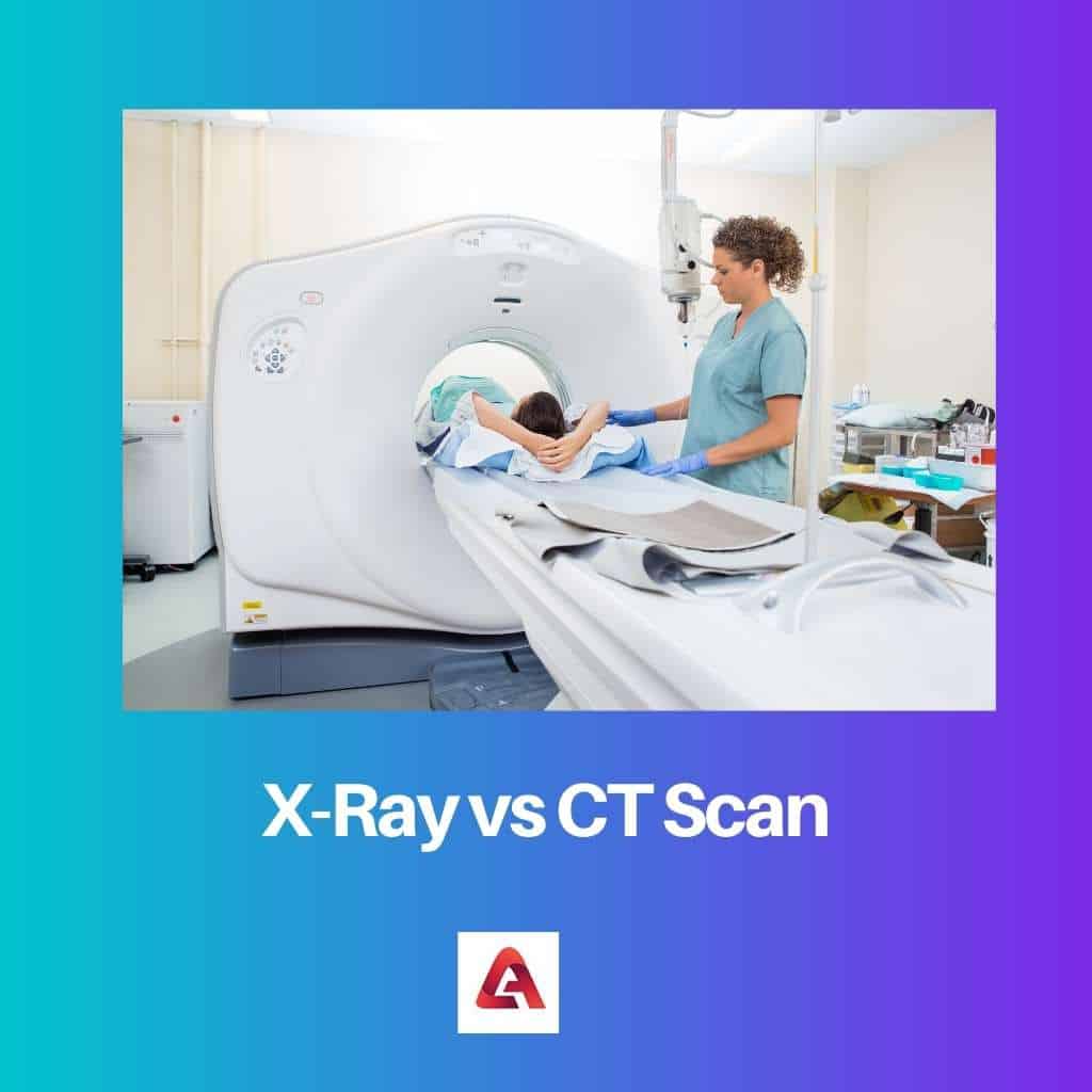 Ct X Ray Difference