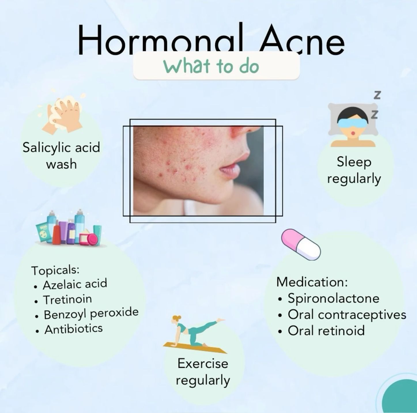 Cure Hormonal Acne Naturally