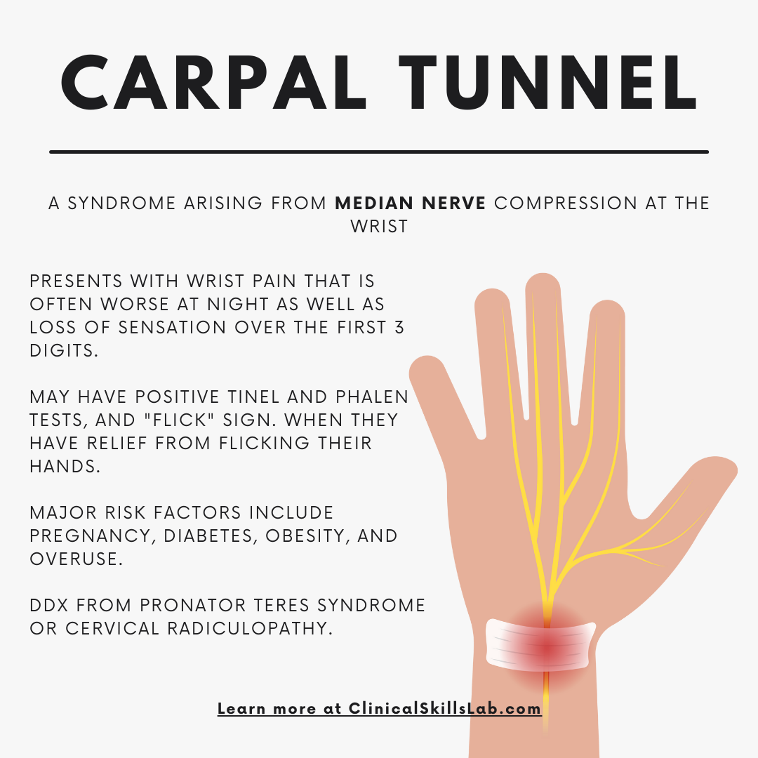 Curing Carpal Tunnel Naturally
