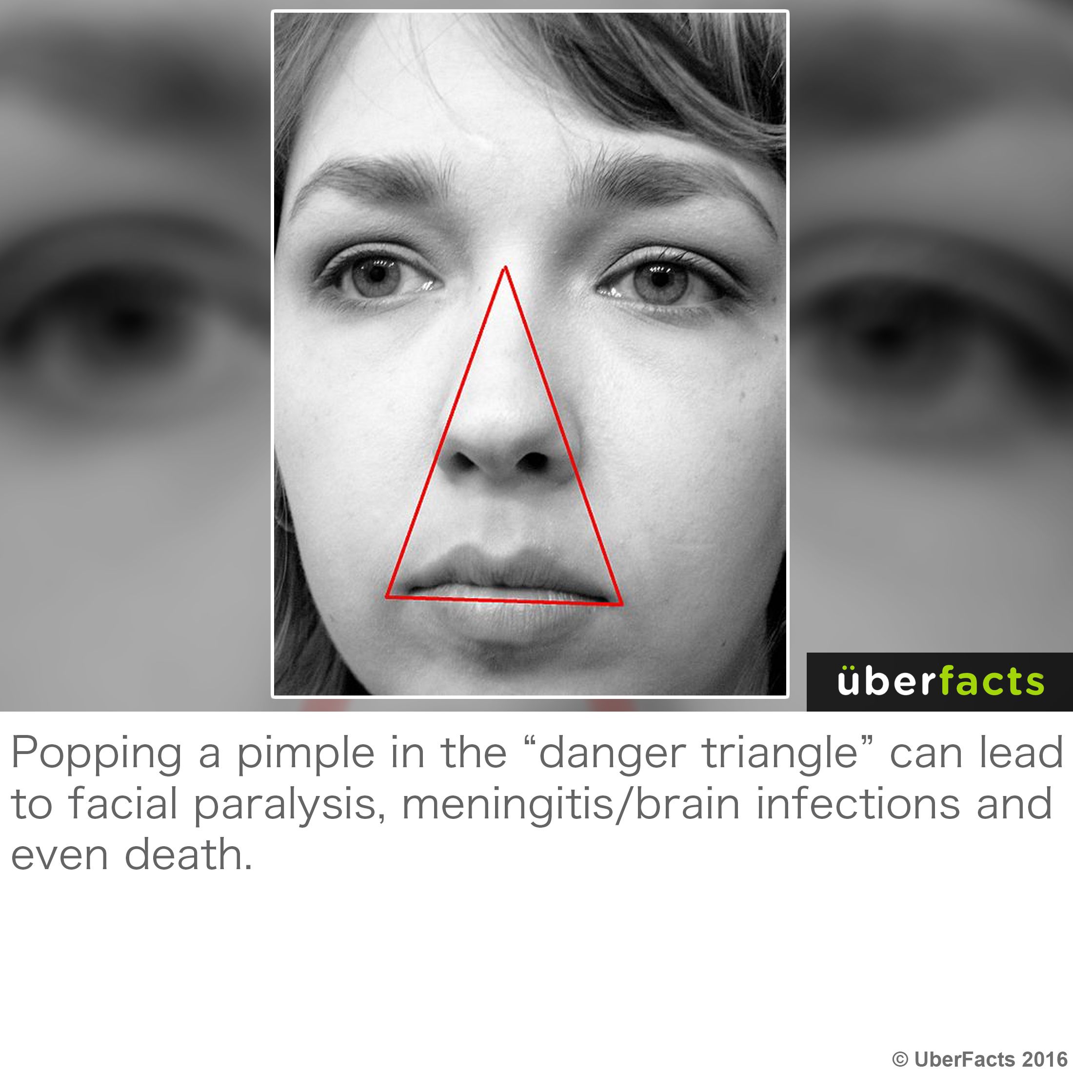 Danger Triangle Of The Face