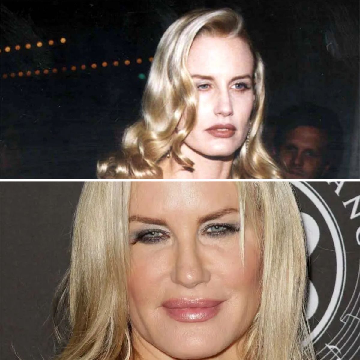 Daryl Hannah Face Surgery