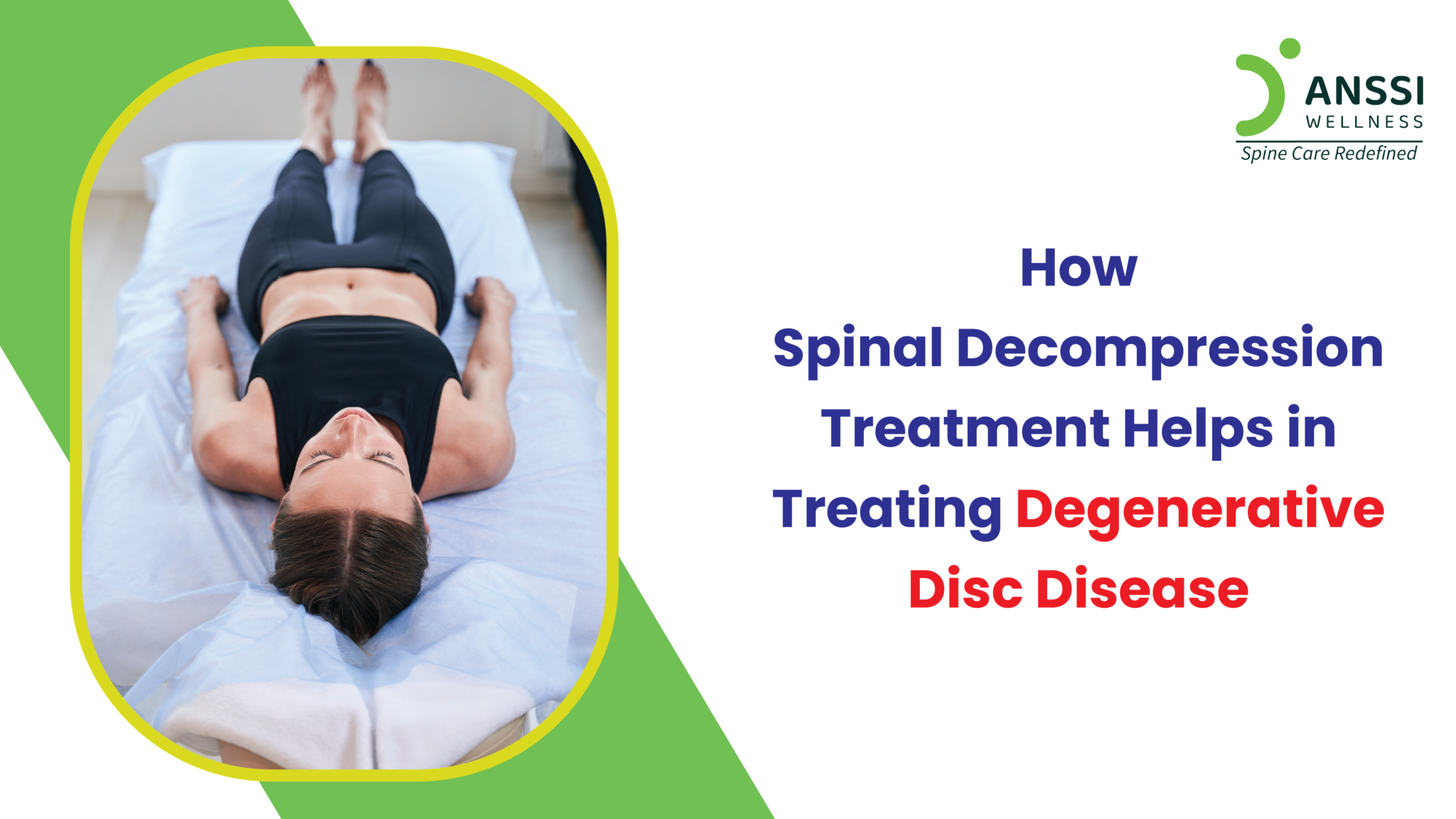 Degenerative Disc Disease Treatment