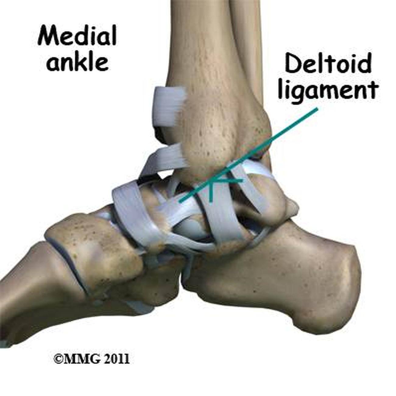 Deltoid Ligament Tears