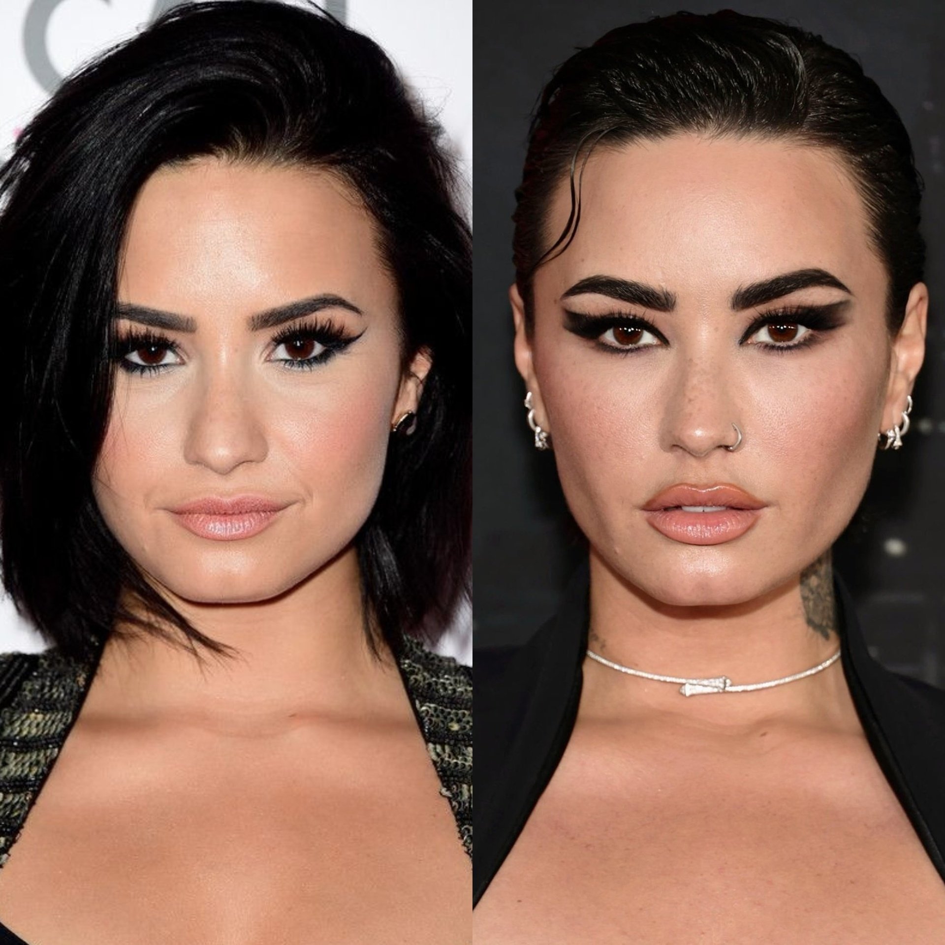 Demi Lovato Face Surgery
