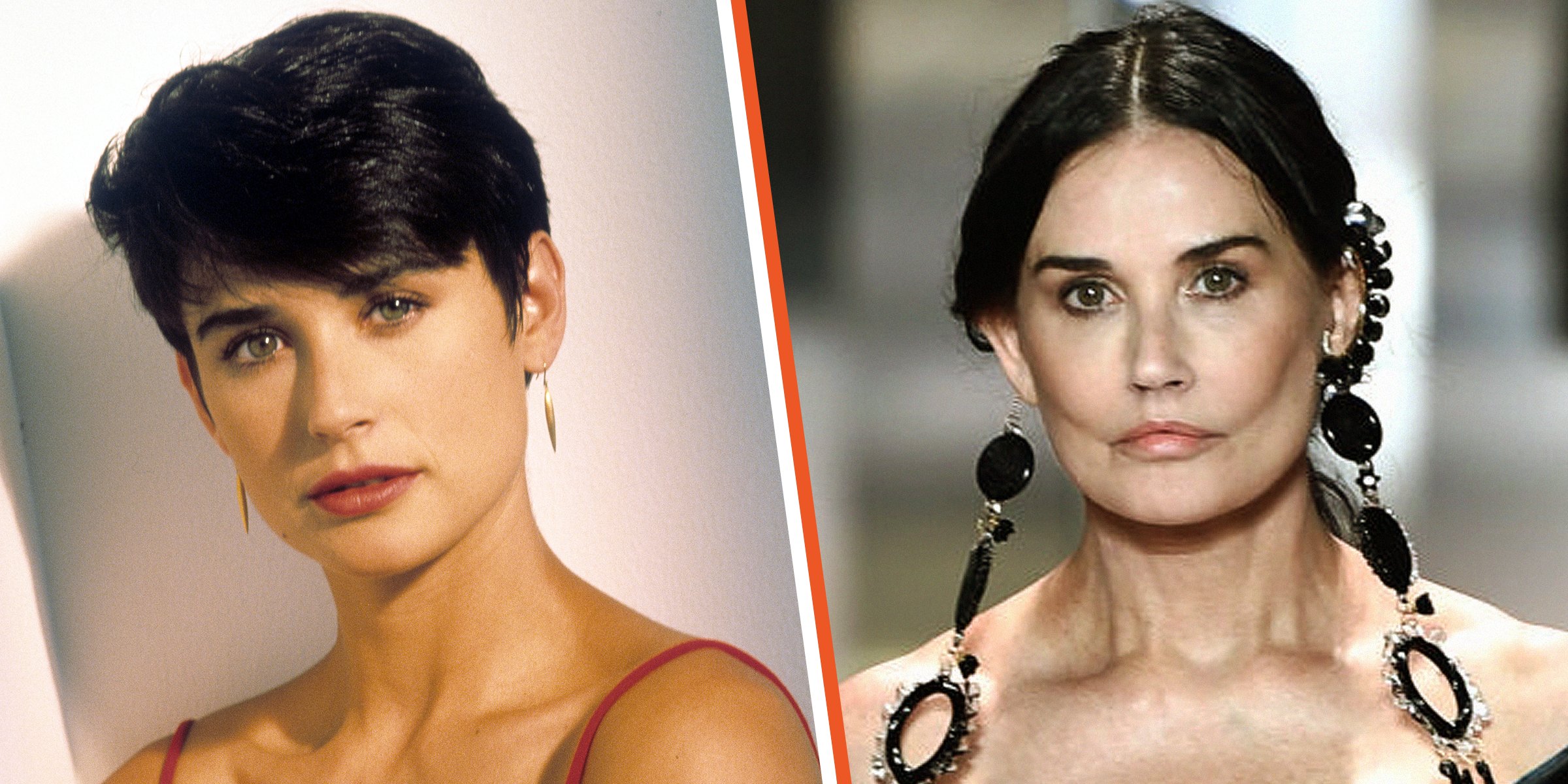 Demi Moore Face Surgeries