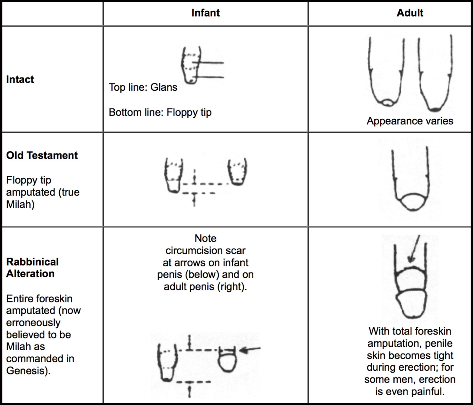 Diagram Circumcised Vs Uncircumcised