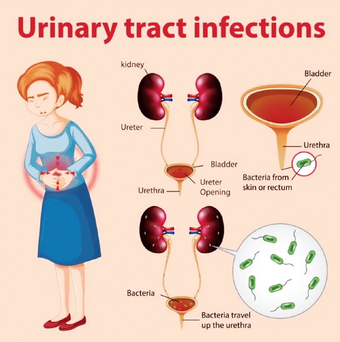 Diarrhoea And Uti