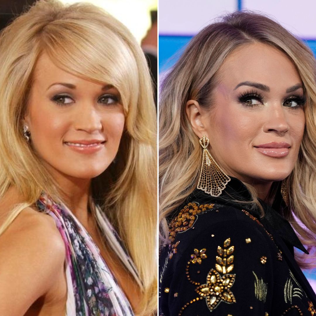 Did Carrie Underwood Have Face Surgery