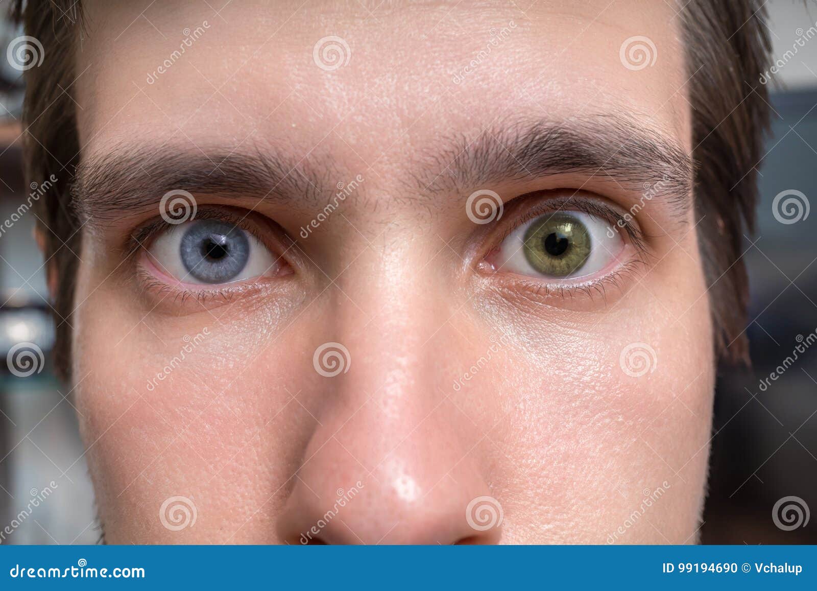 Different Colored Eyes