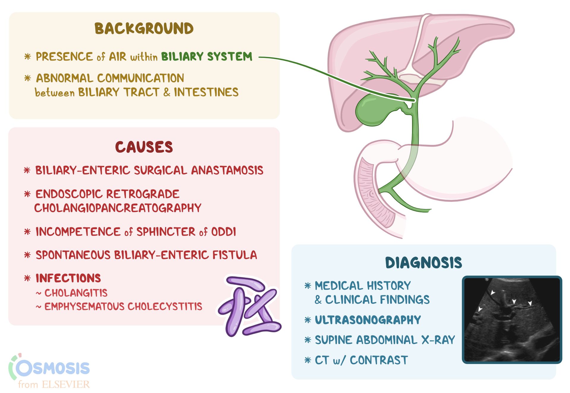 Dilated Common Bile Duct