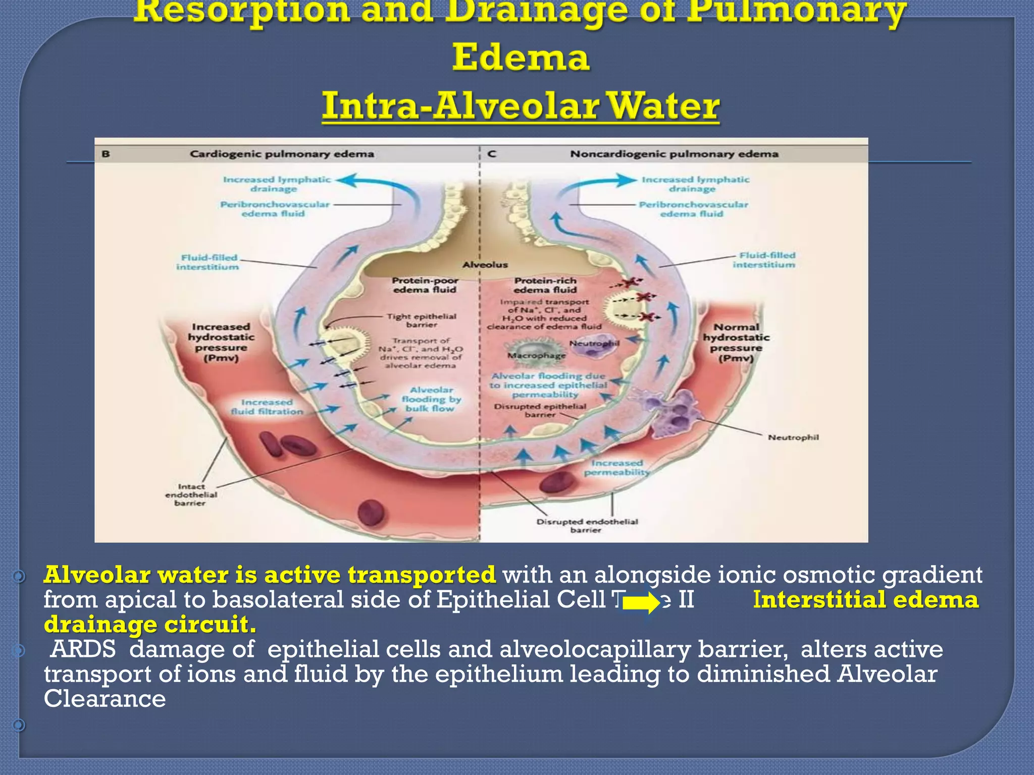 Diuretics Pulmonary Edema