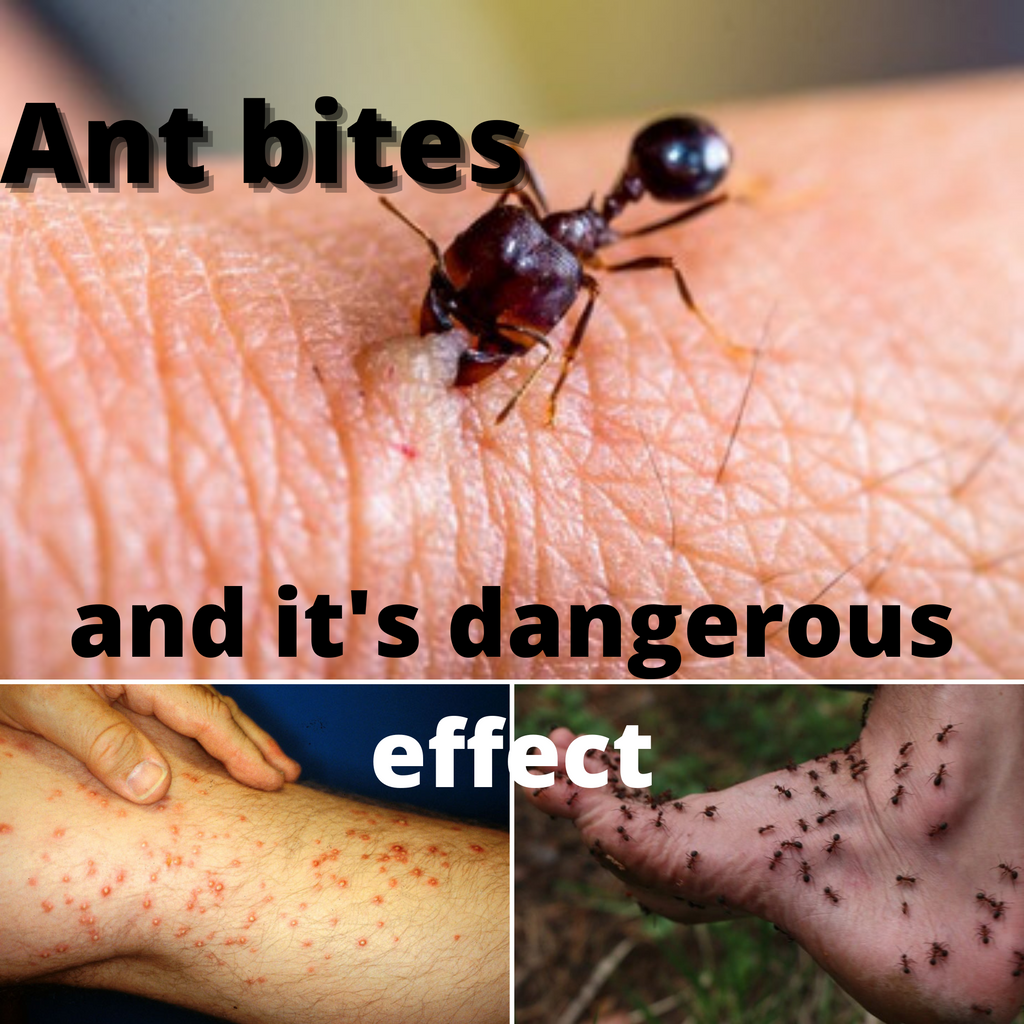 Do Ants Bite Or Sting