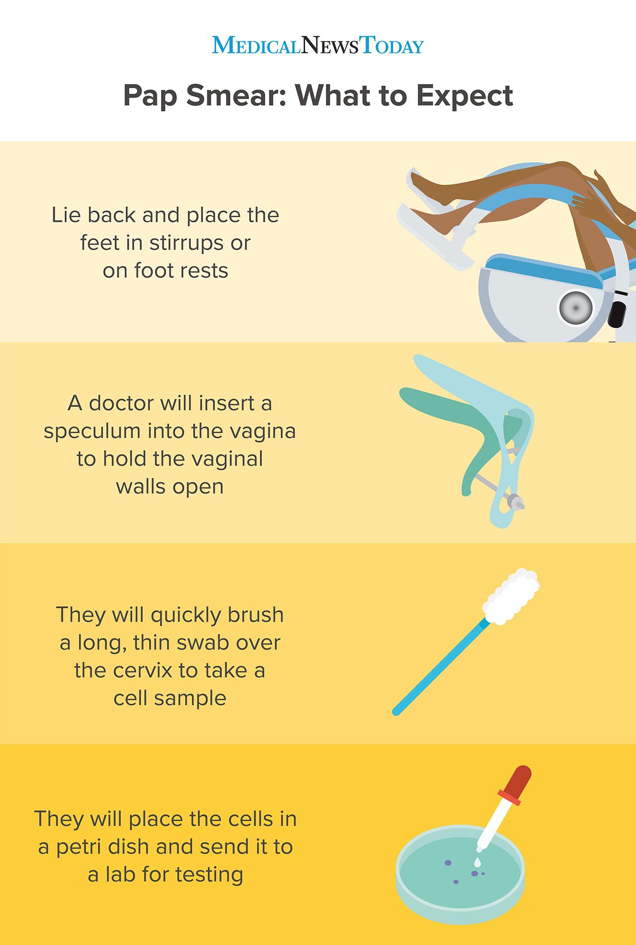 Do Pap Smear Test Hurt