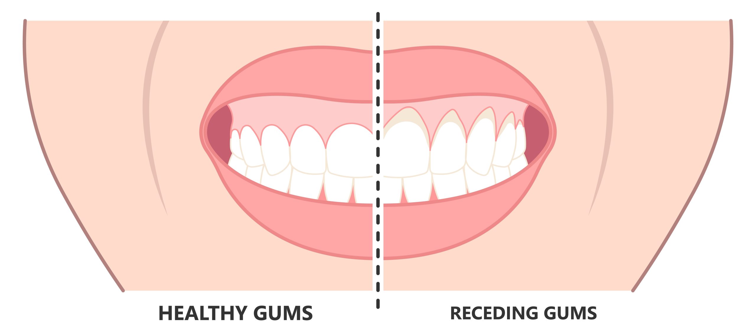 Do Your Gums Grow Back
