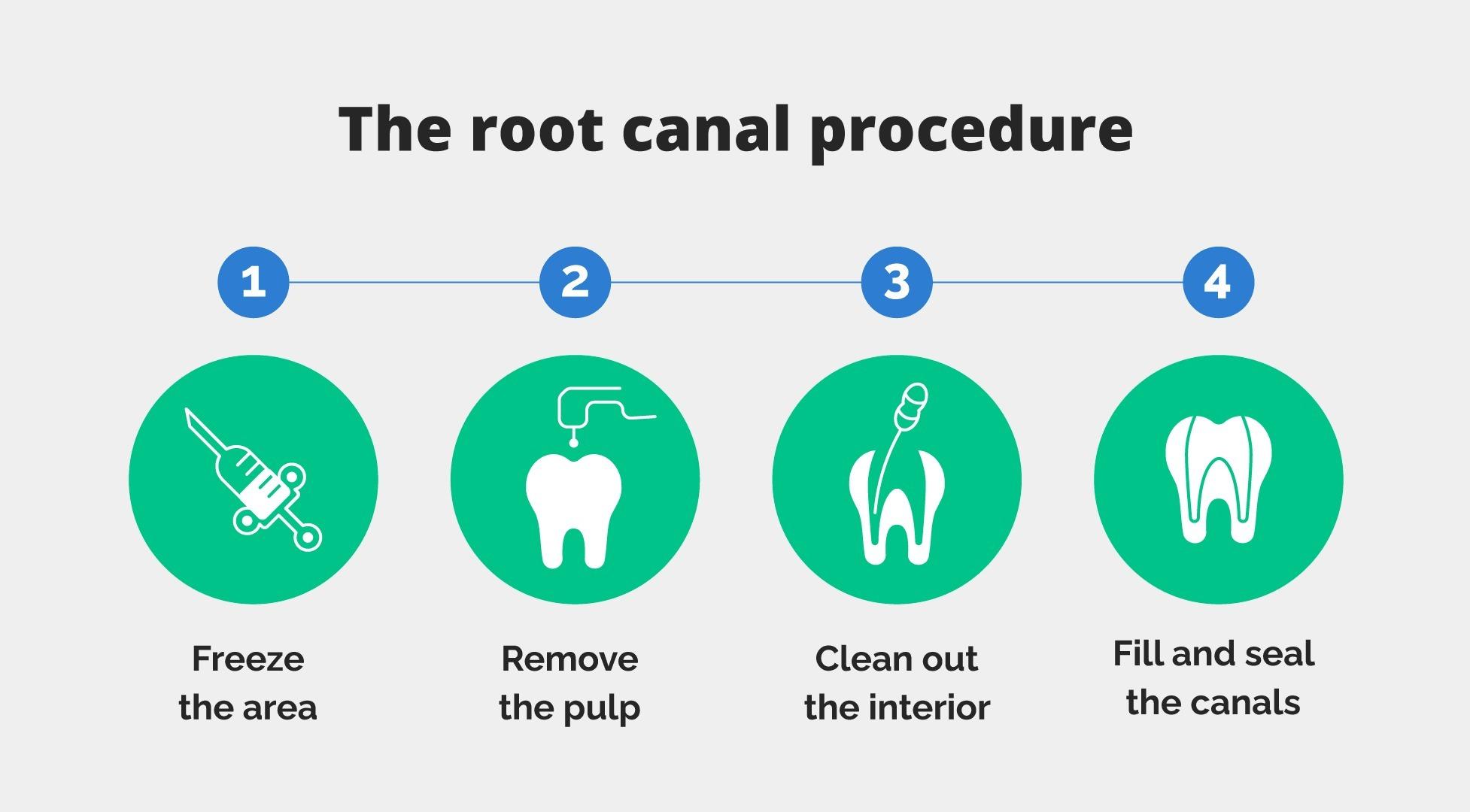 Does A Root Canal Hurt