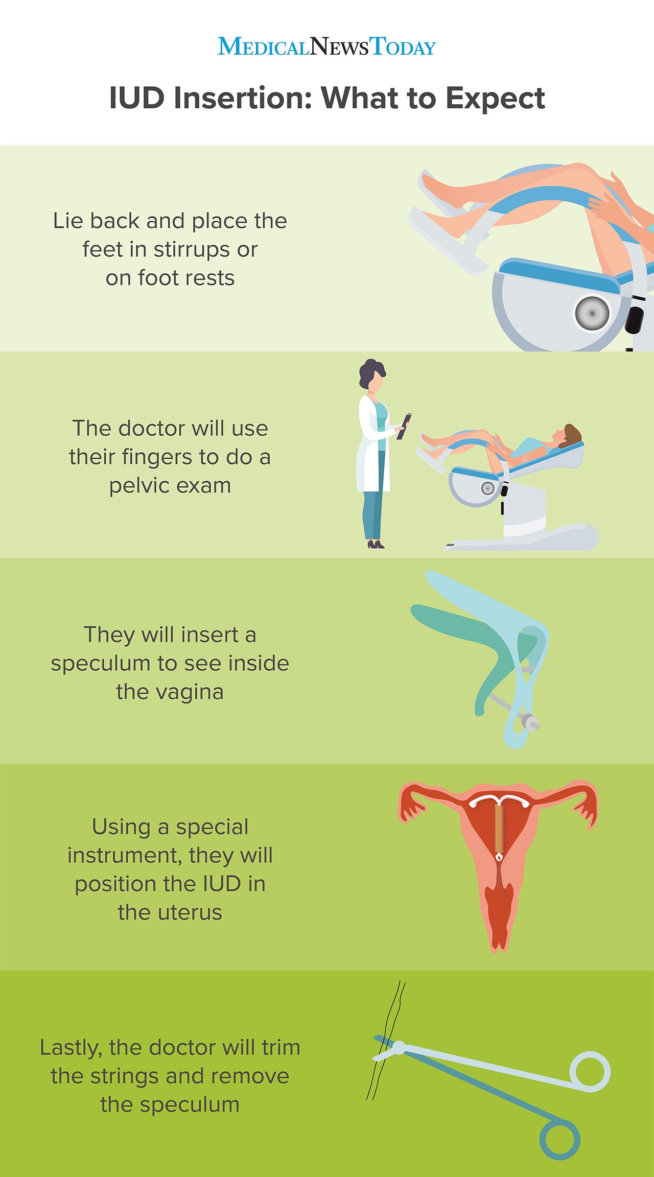 Does Getting An Iud Hurt