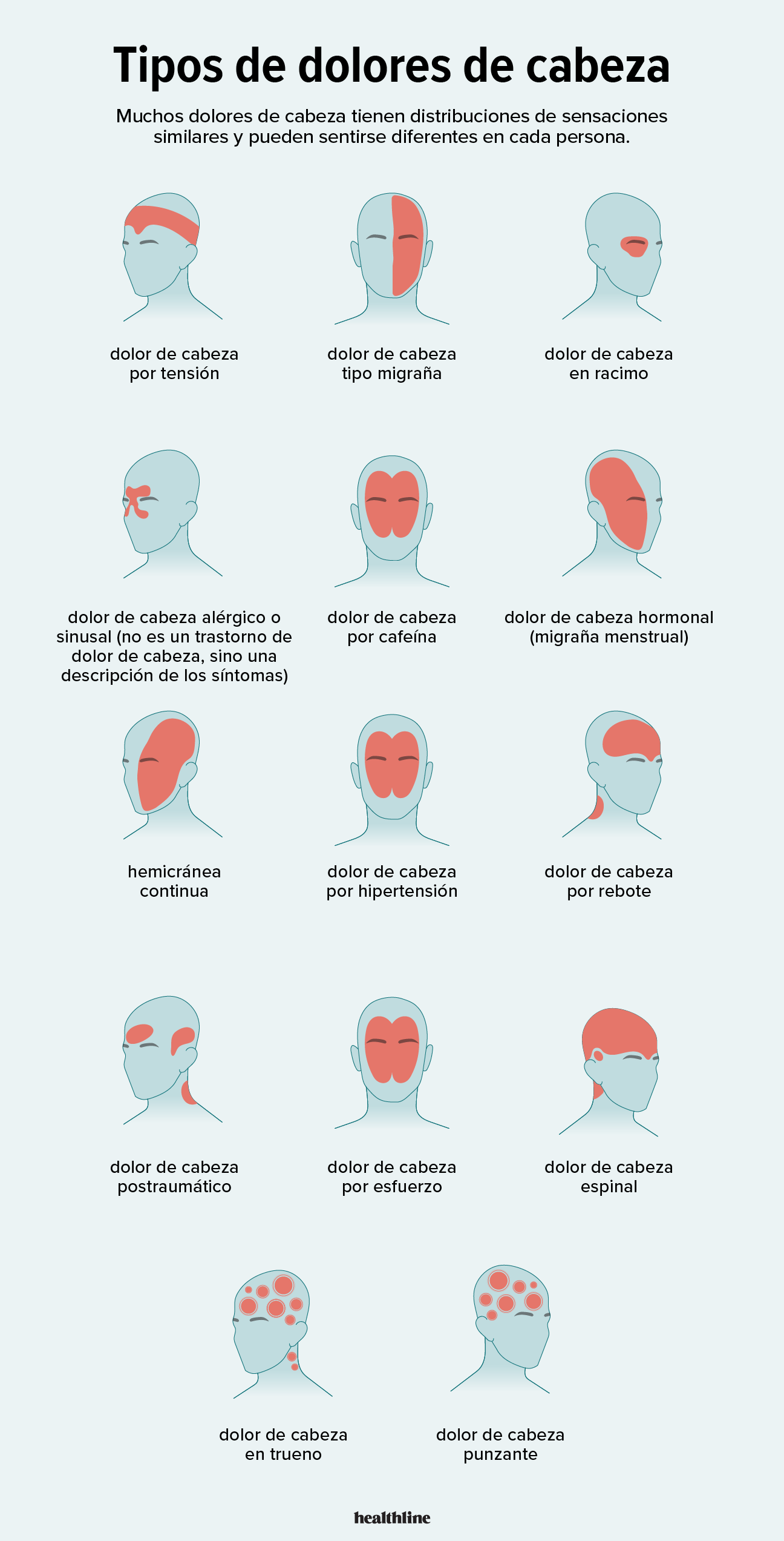 Dolores De Cabeza Tipos