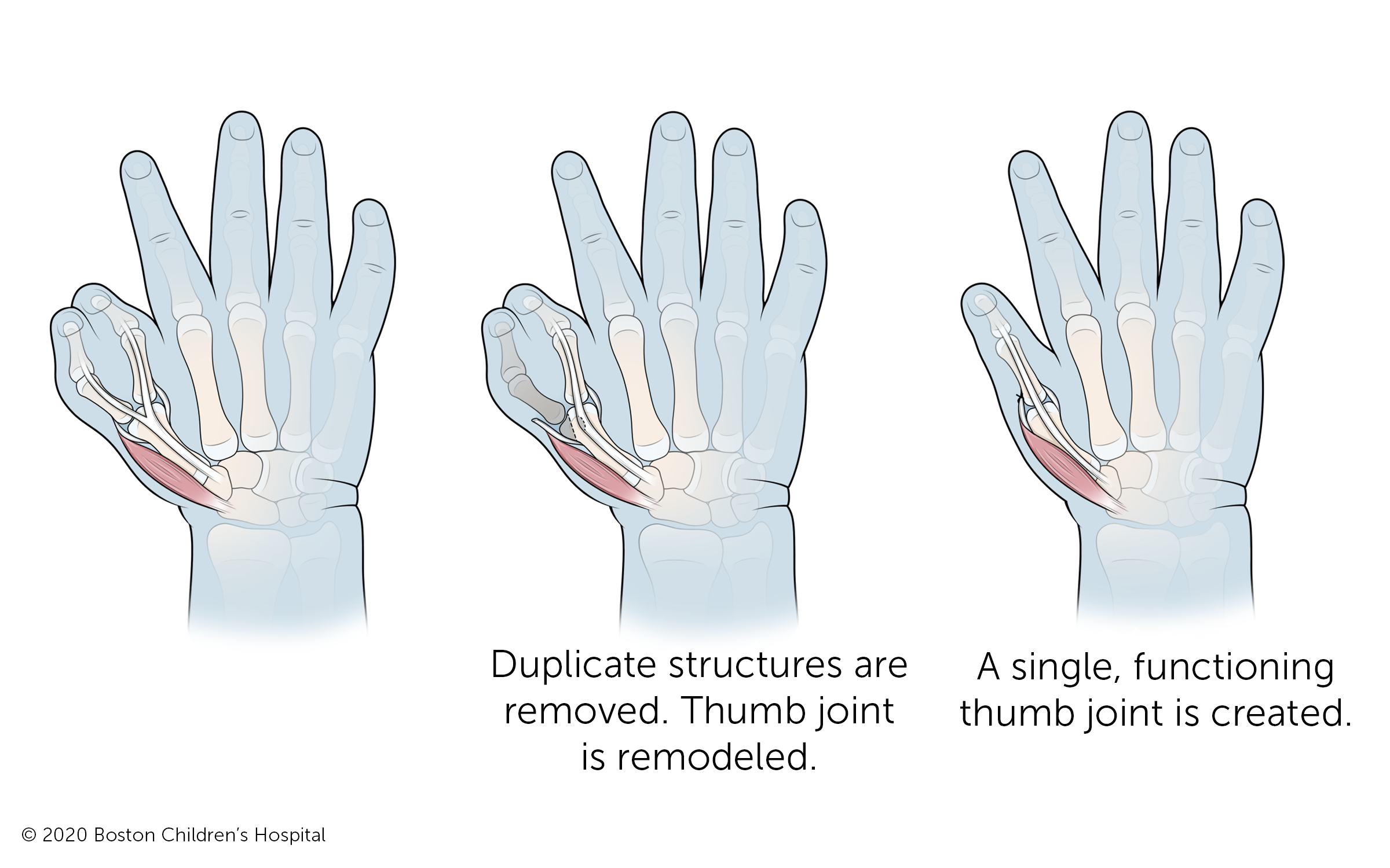 Double Jointed Finger Bones