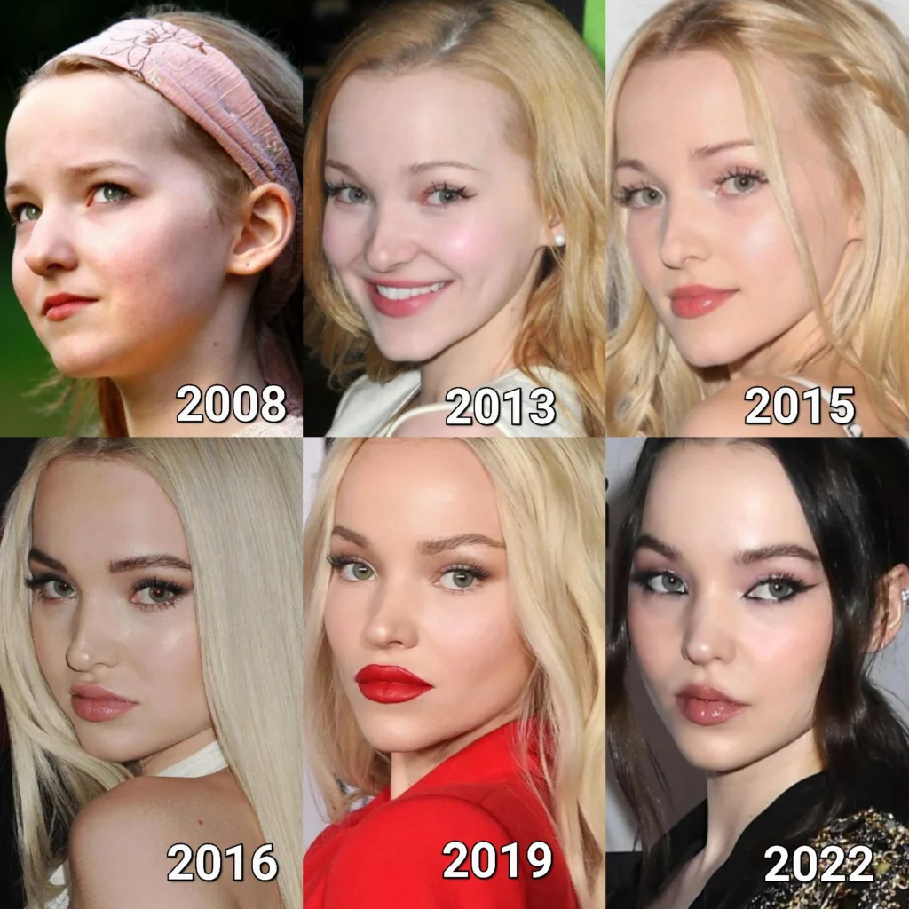 Dove Cameron Surgery Face