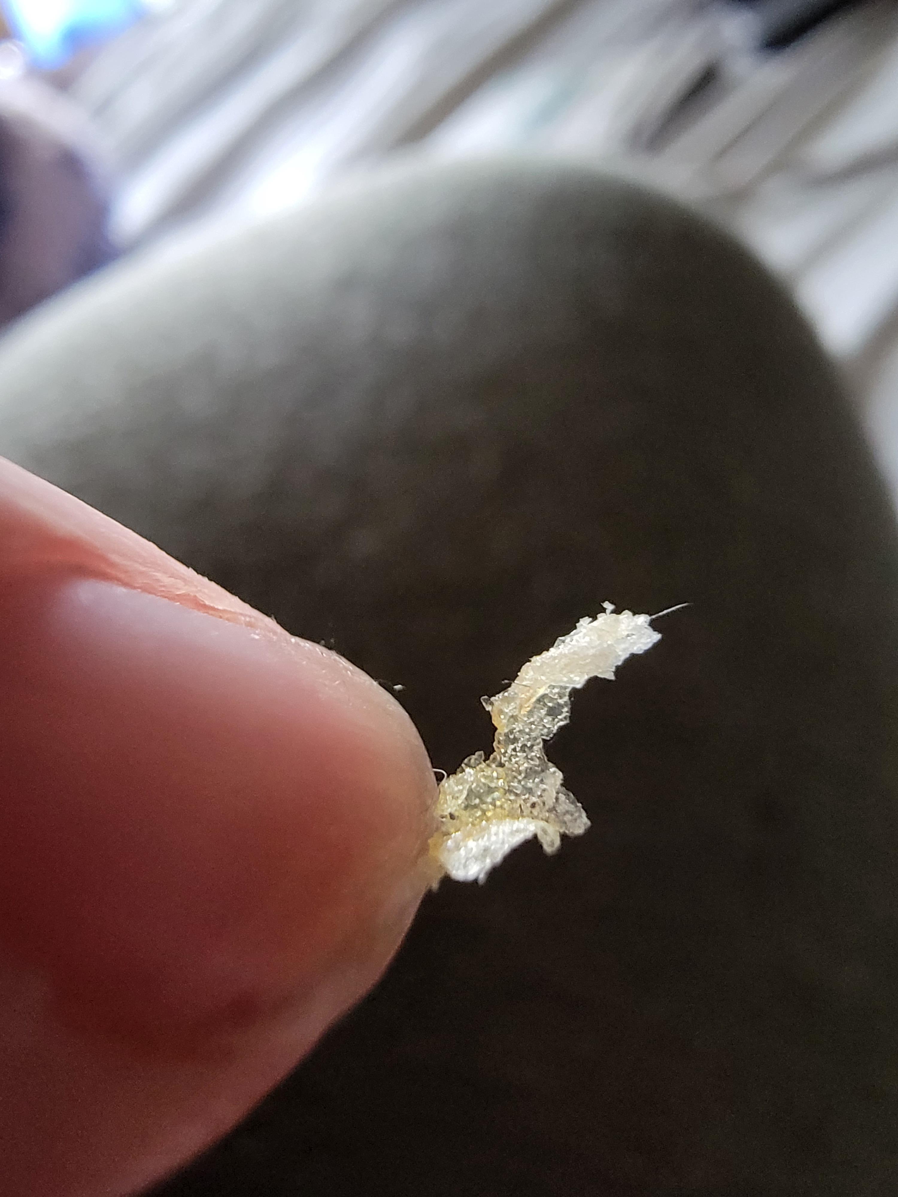 Dry Skin Inside Ears