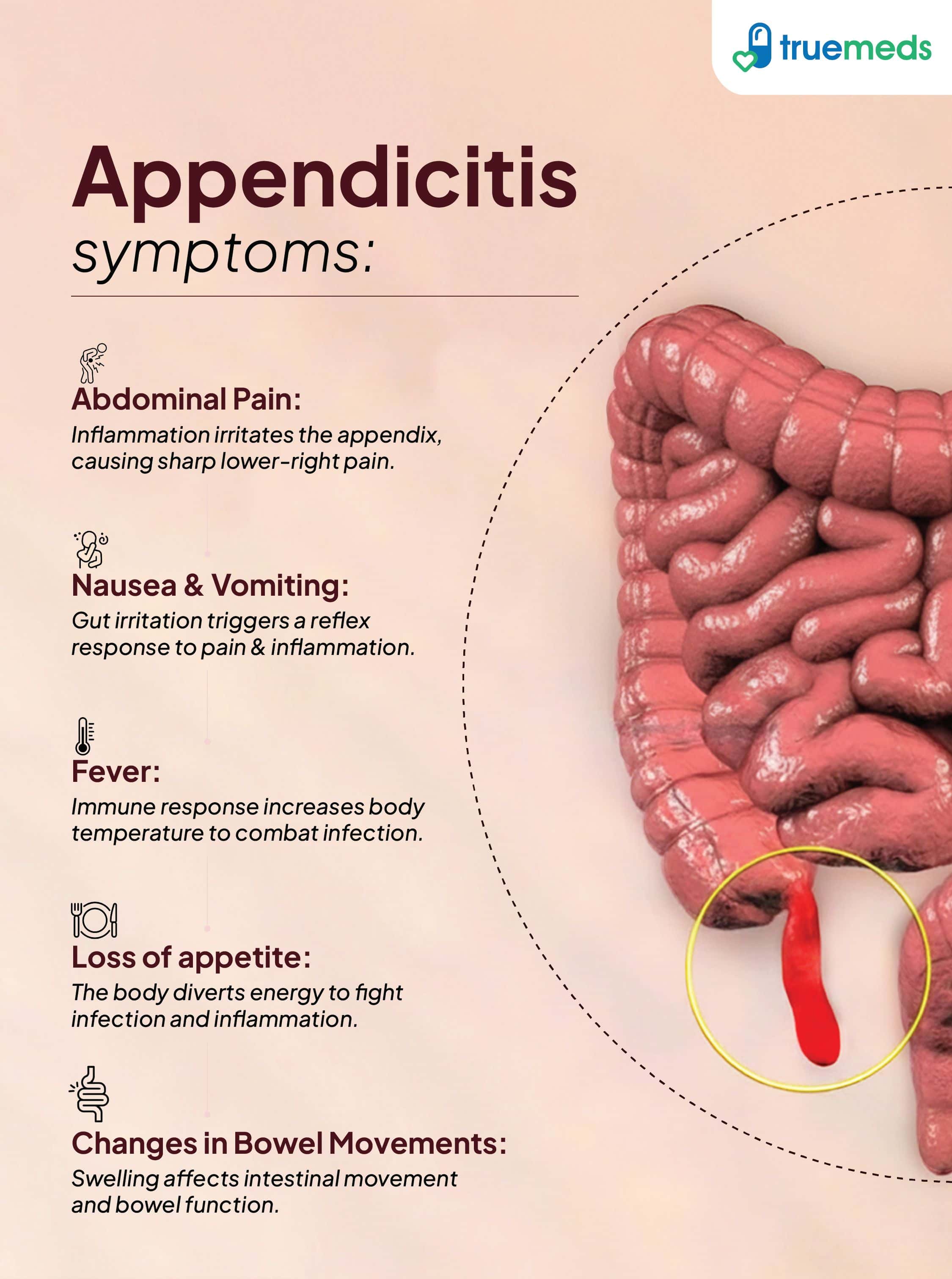 Early Signs Of A Appendicitis