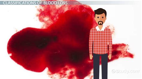 Effects Of Losing Too Much Blood