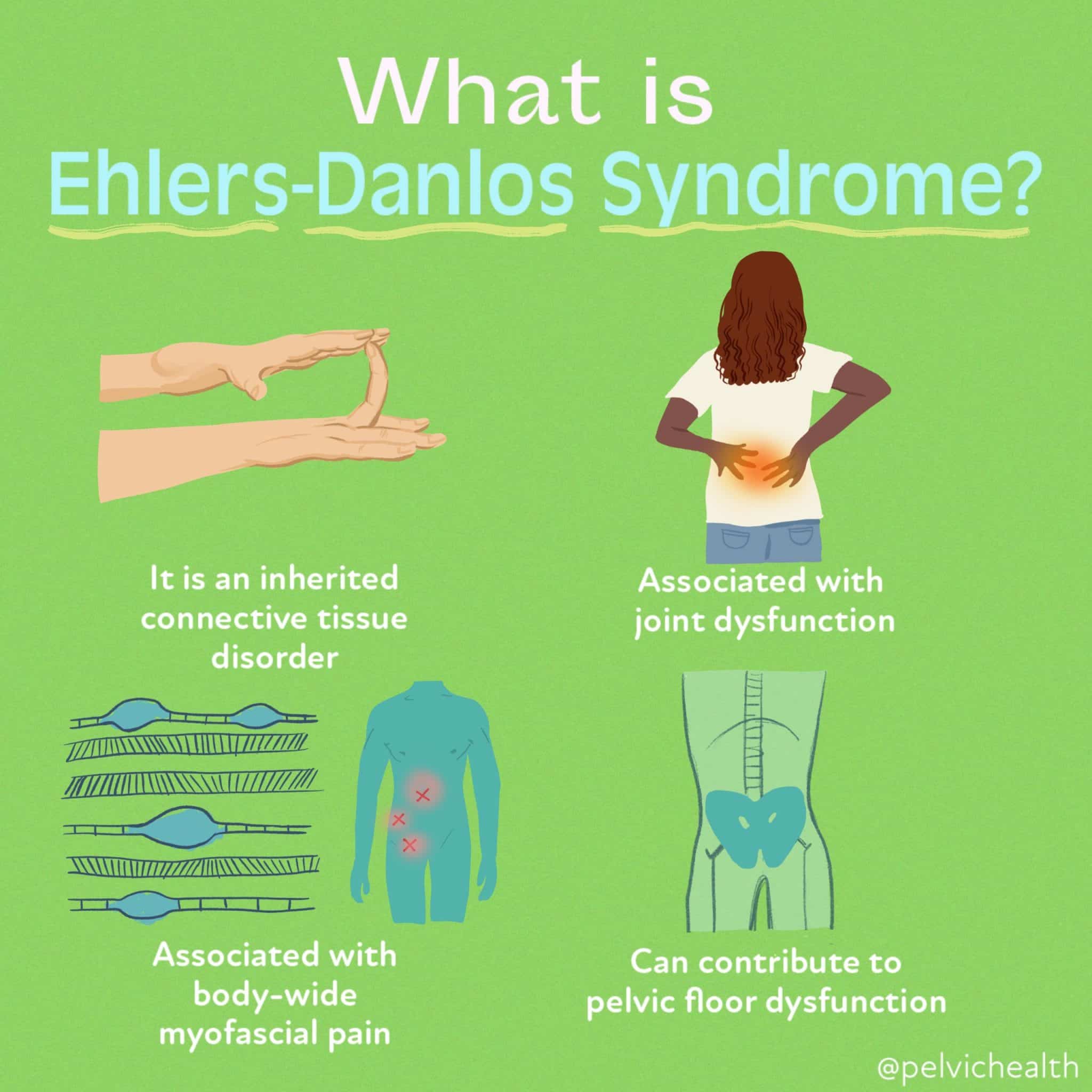 Ehlersdanlos Syndrome Medication