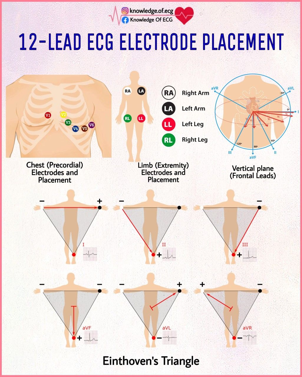 Ekg Electrodes