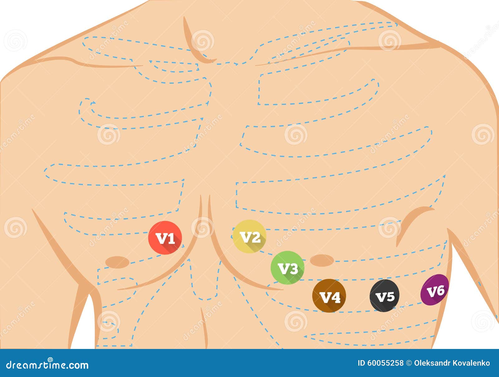 Electrocardiography Placement