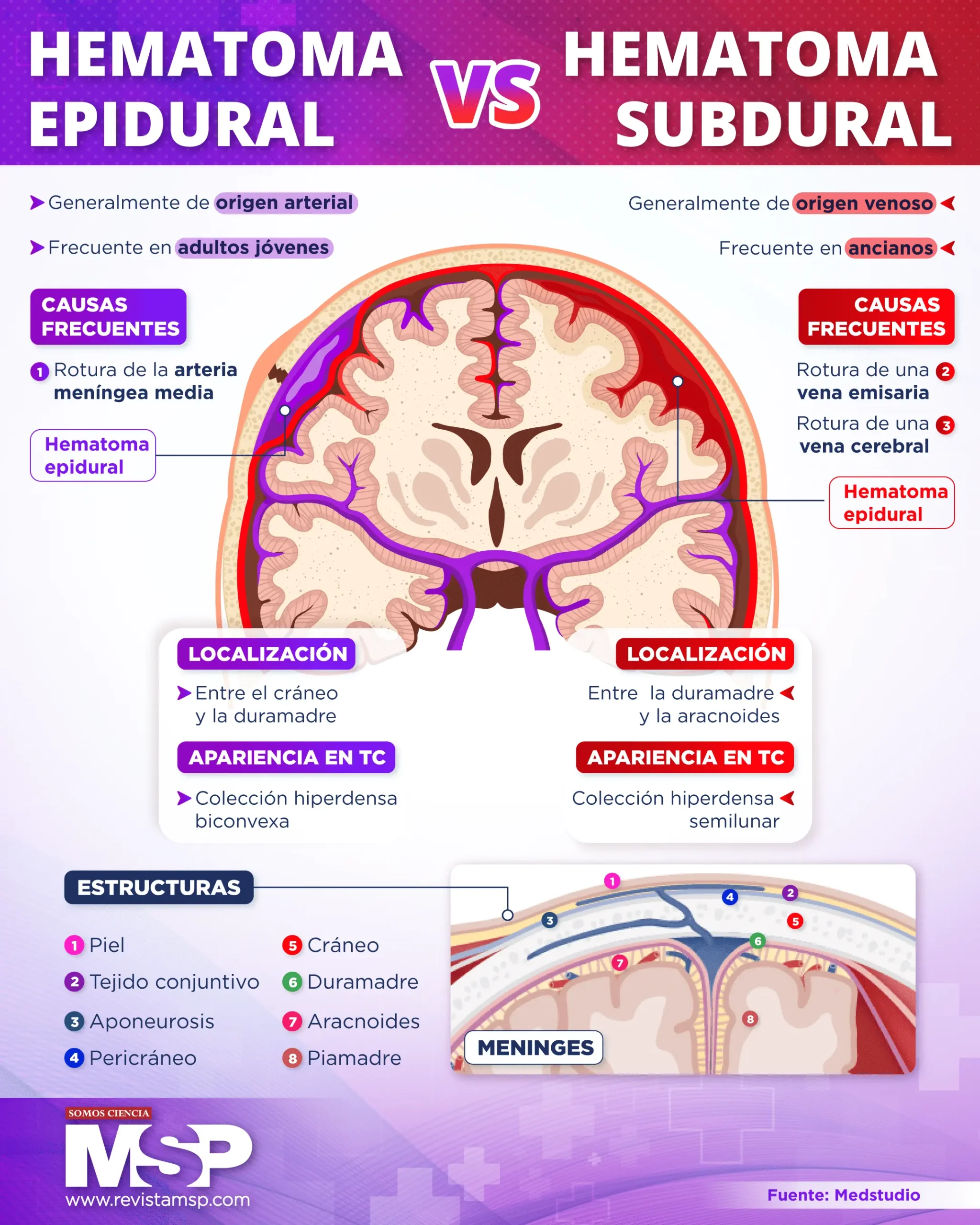 Epidural In Spanish