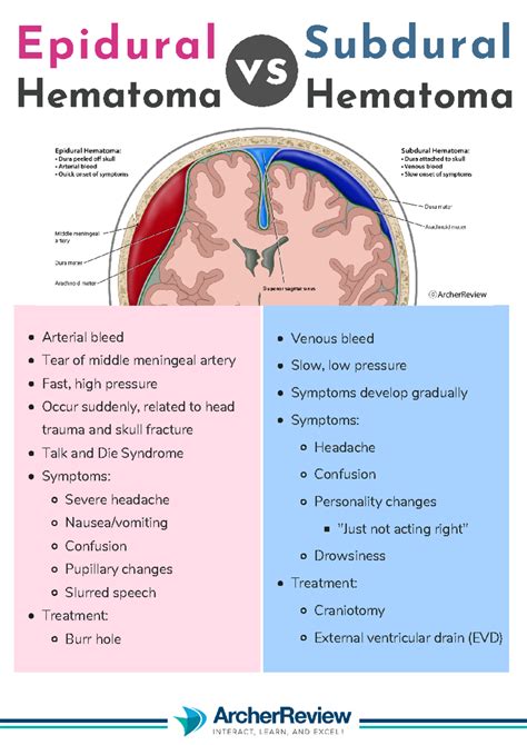 Epidural Vs Subdural