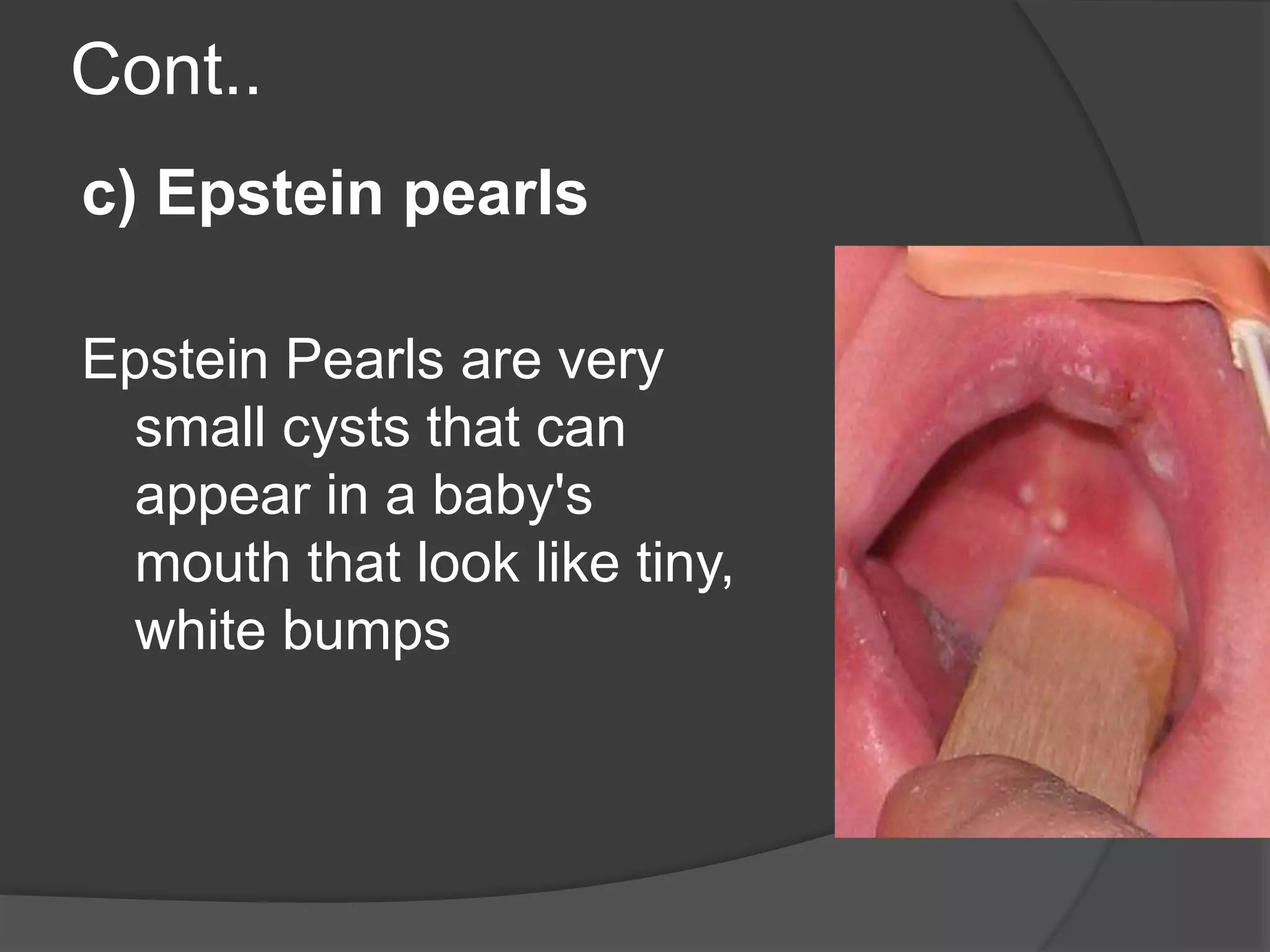 Epstein Pearls Baby