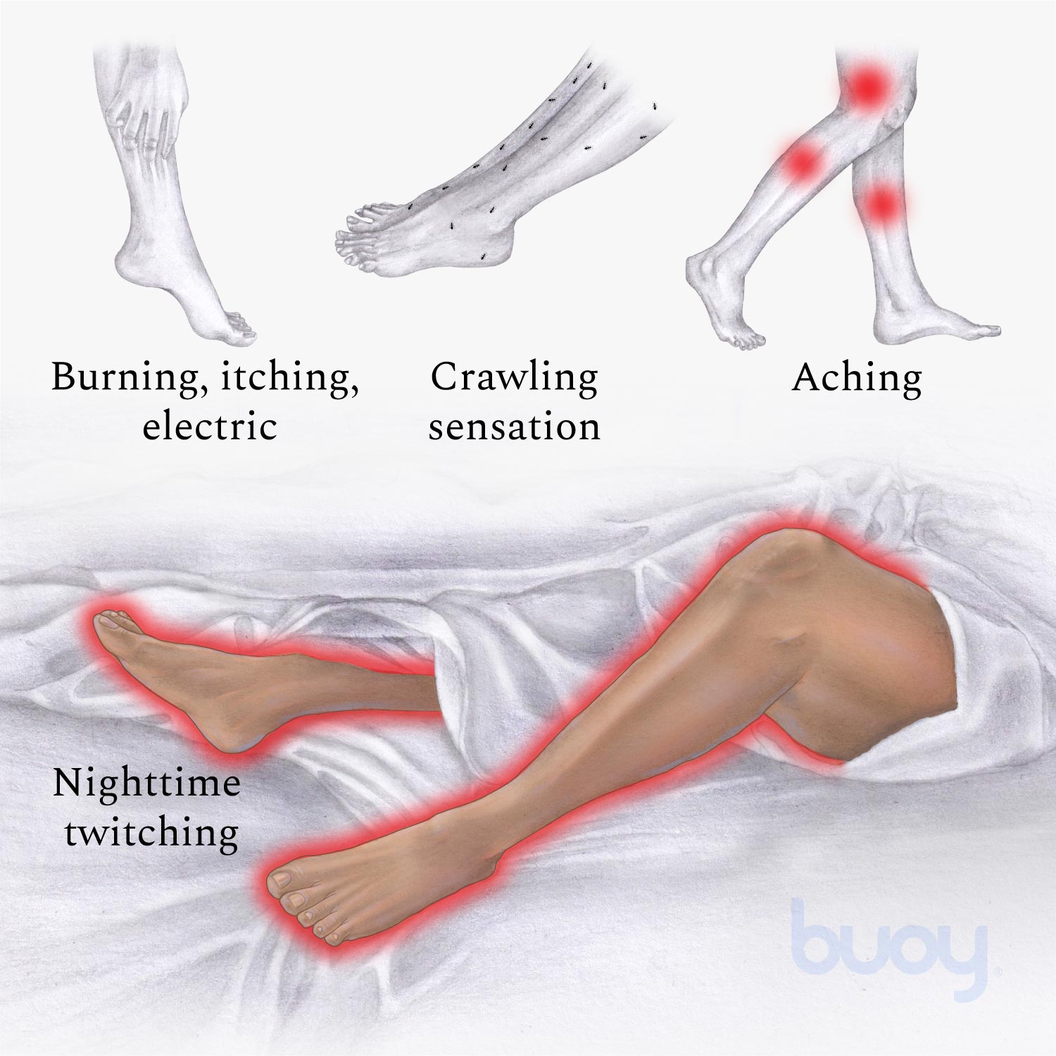 Exercises For Restless Legs