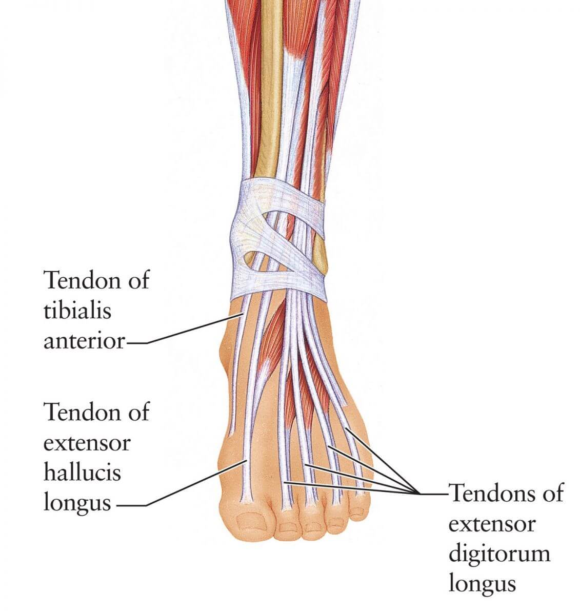 Extensor Tendonitis Foot