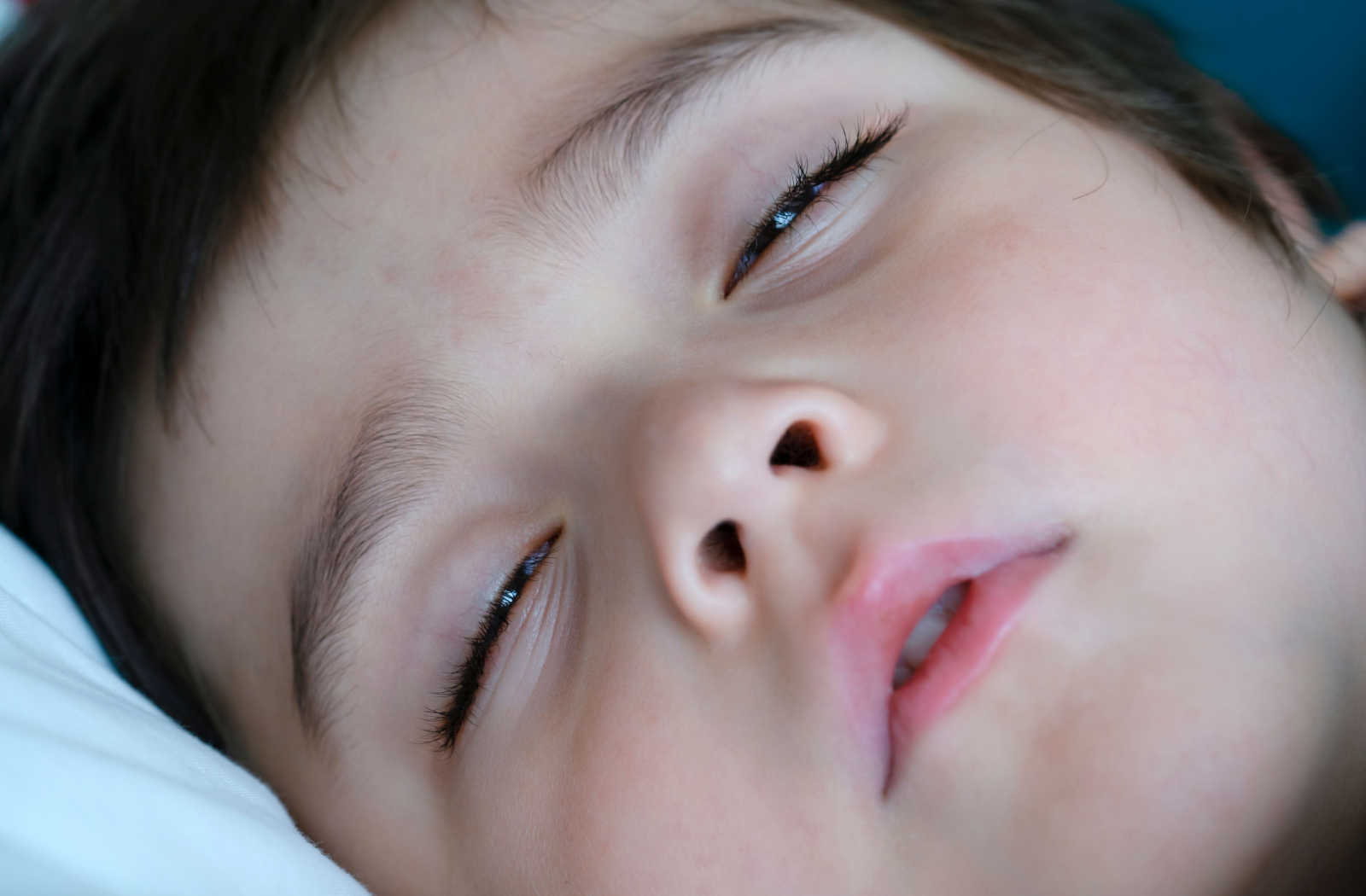 Eyelids Open When Sleeping