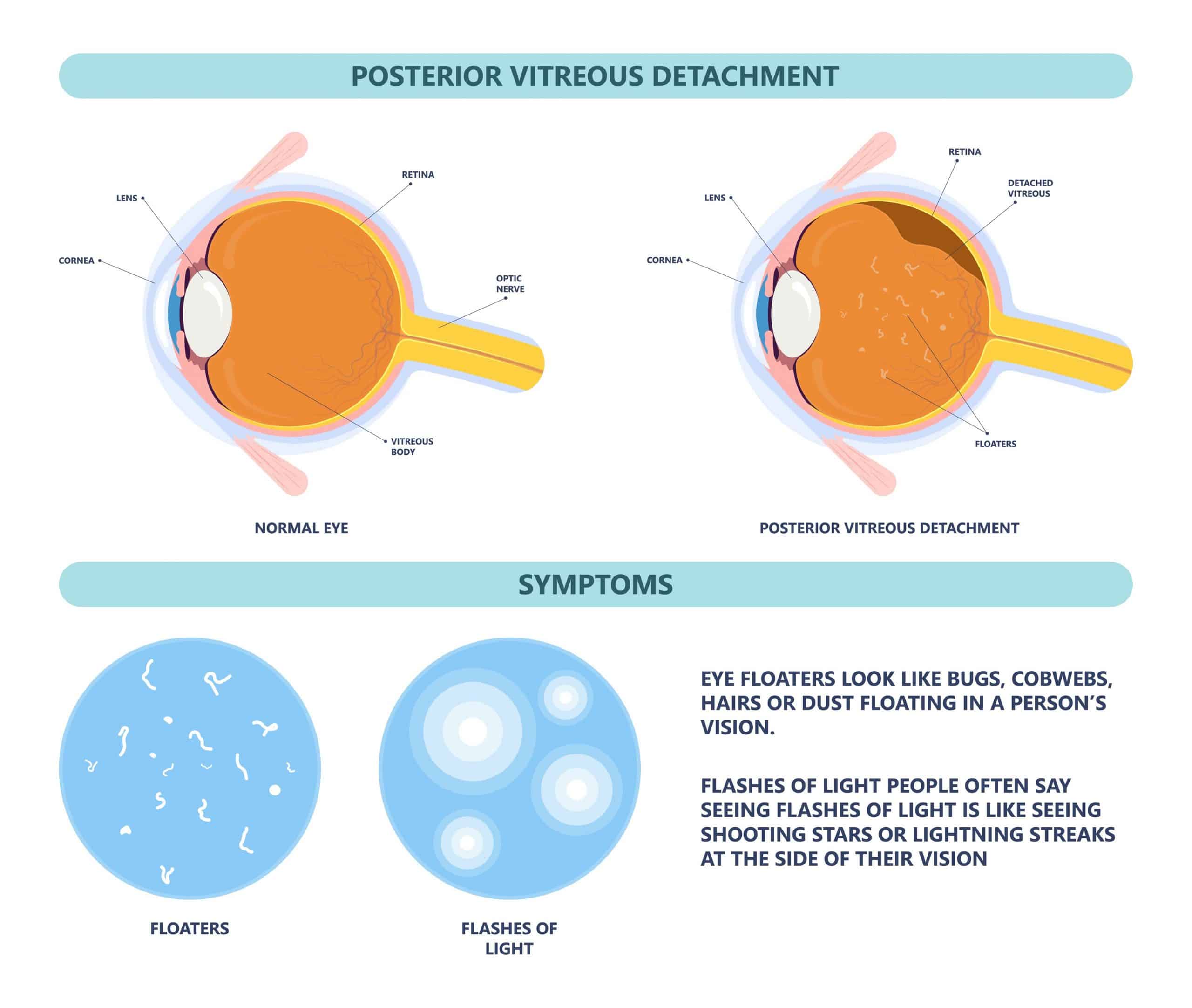 Eyesight Seeing Spots
