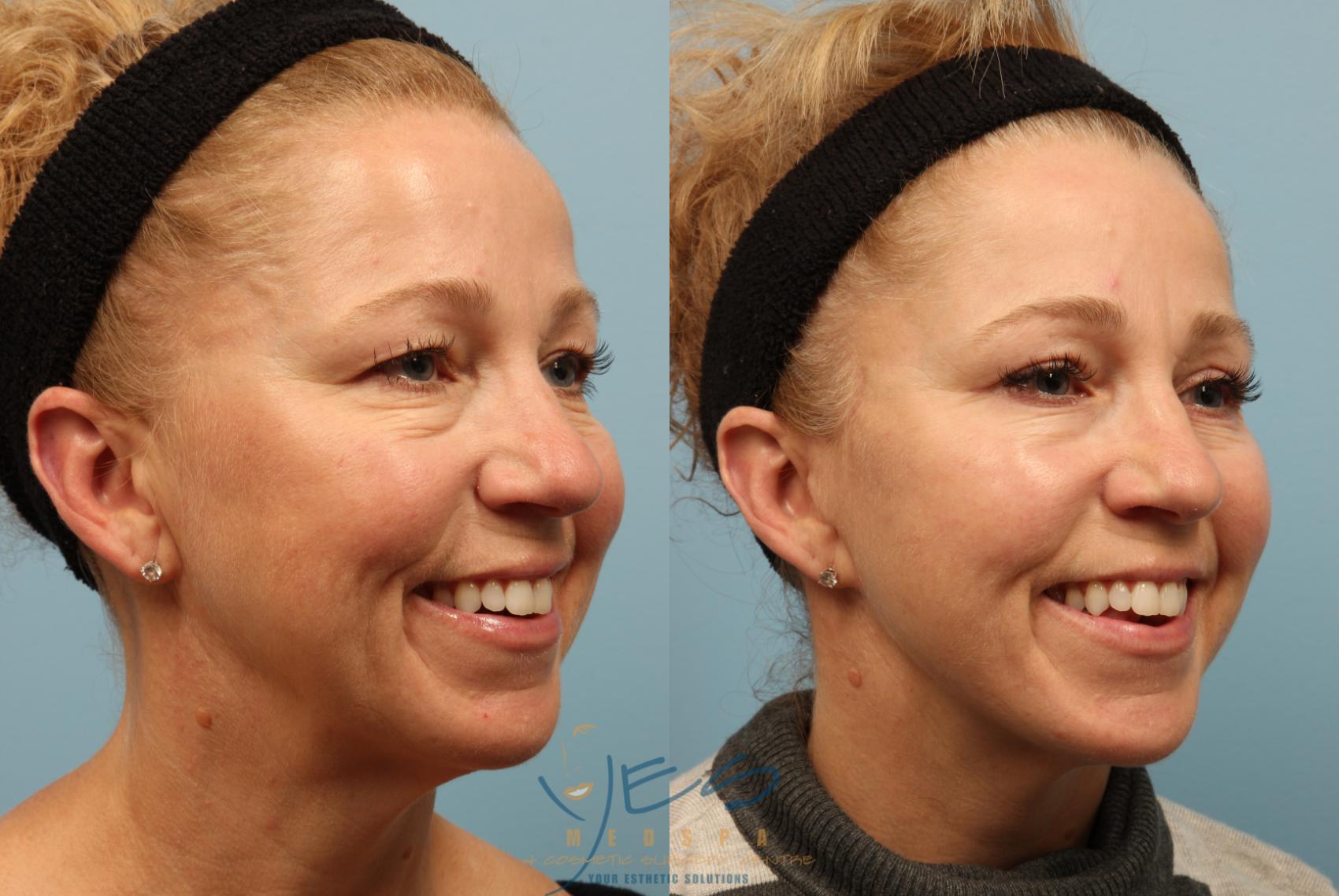 Face Grafting Surgery