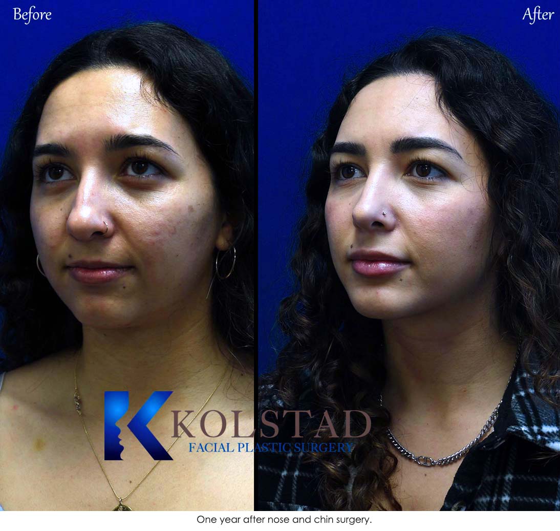 Face Plastic Surgery Near Me