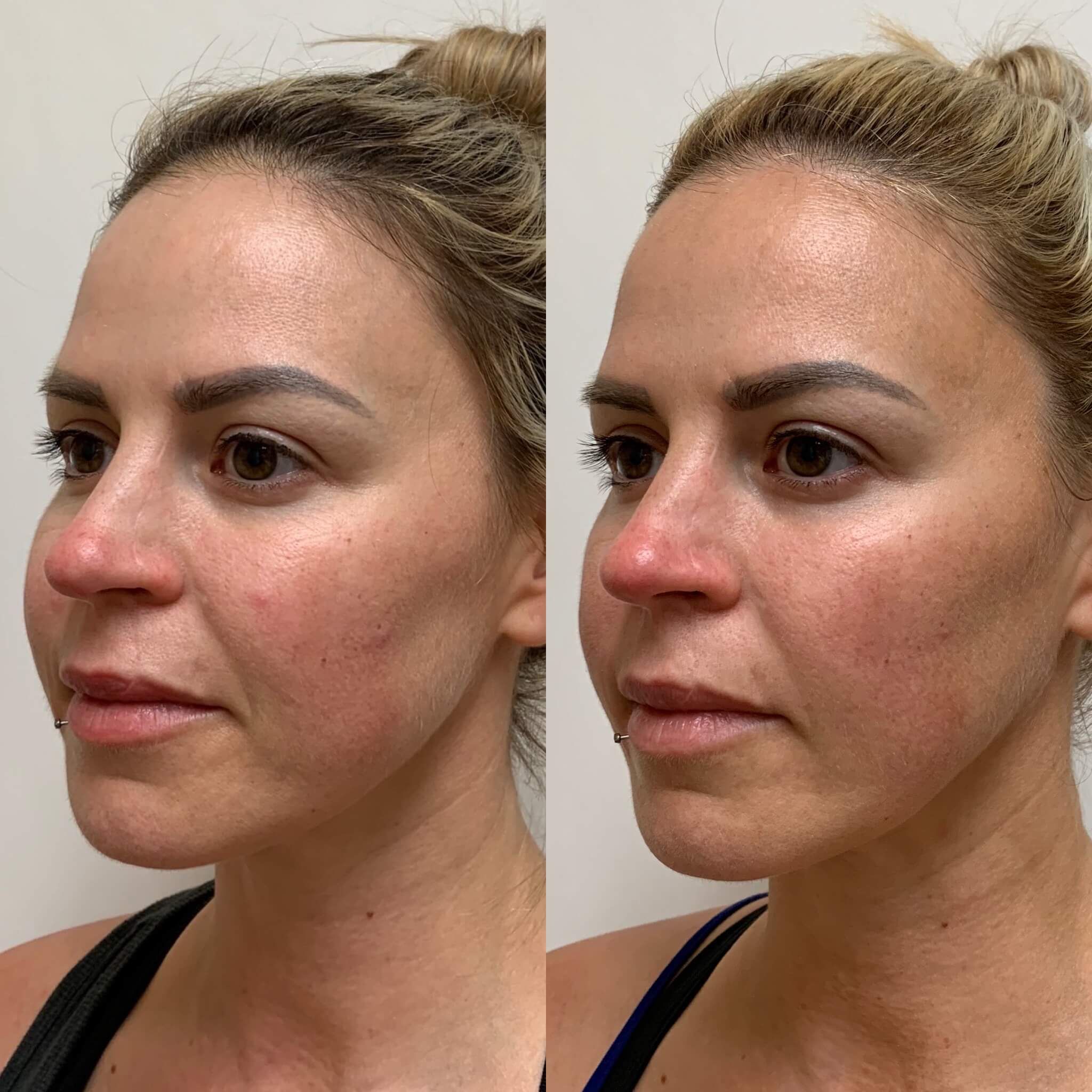 Face Works Plastic Surgery & Med Spa