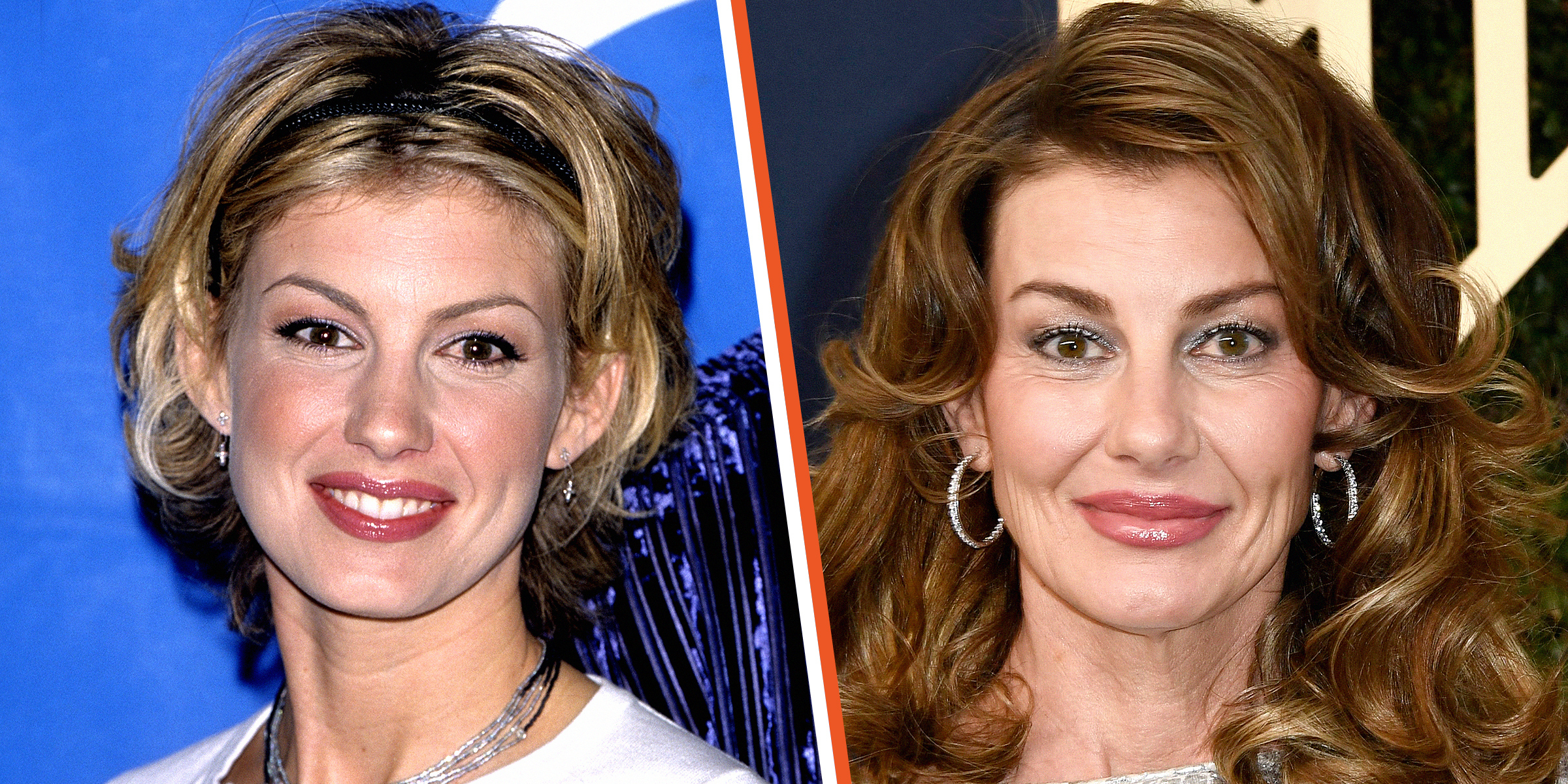 Faith Hill Face Surgery
