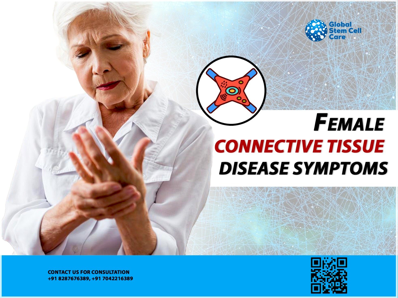 Female Connective Tissue Disease Symptoms