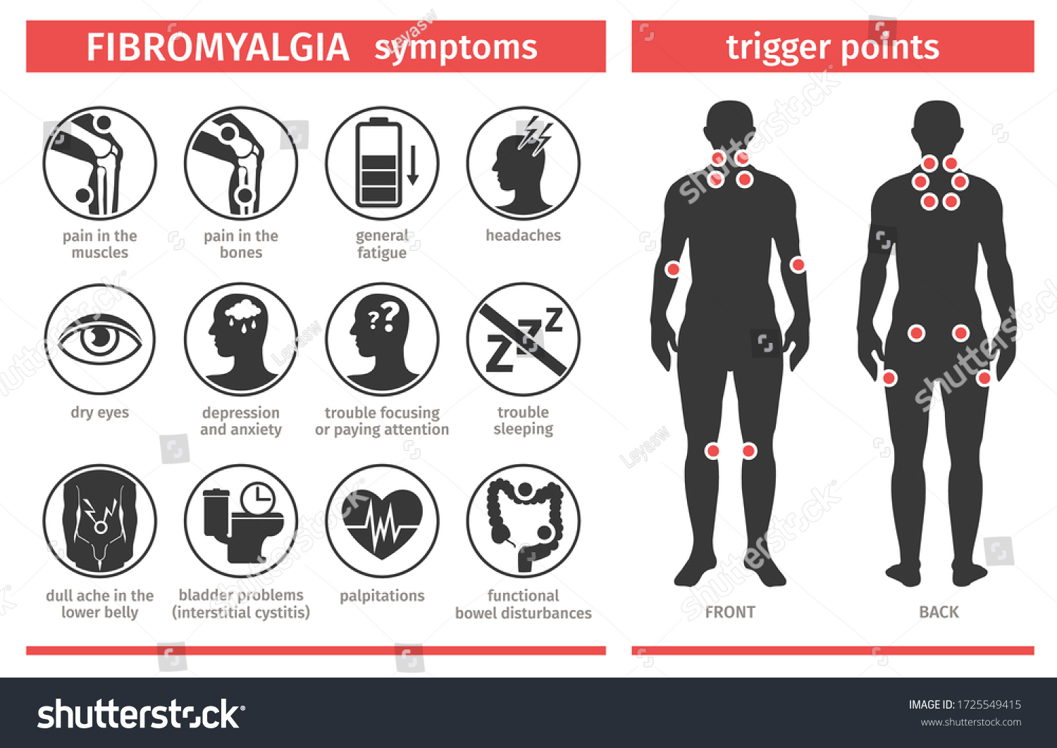 Fibromyalgia Tender Points