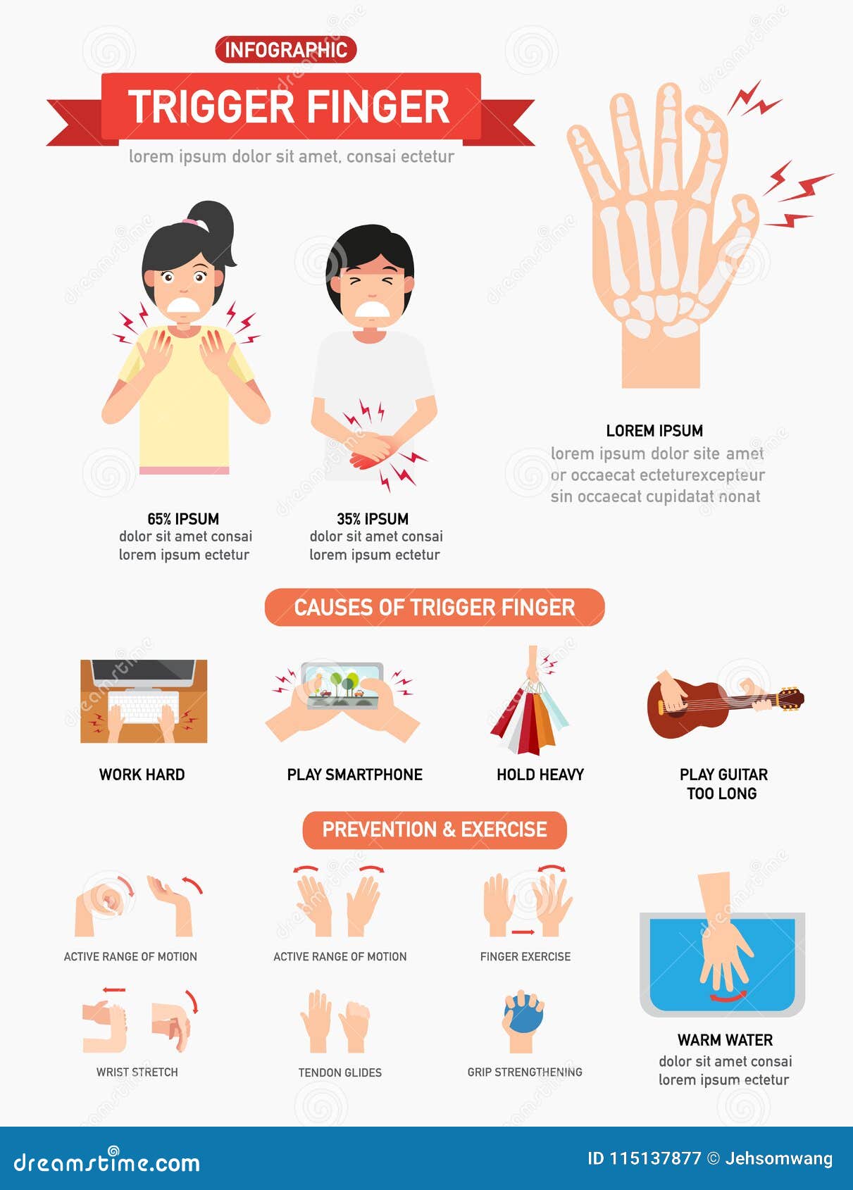 Finger Trigger Causes