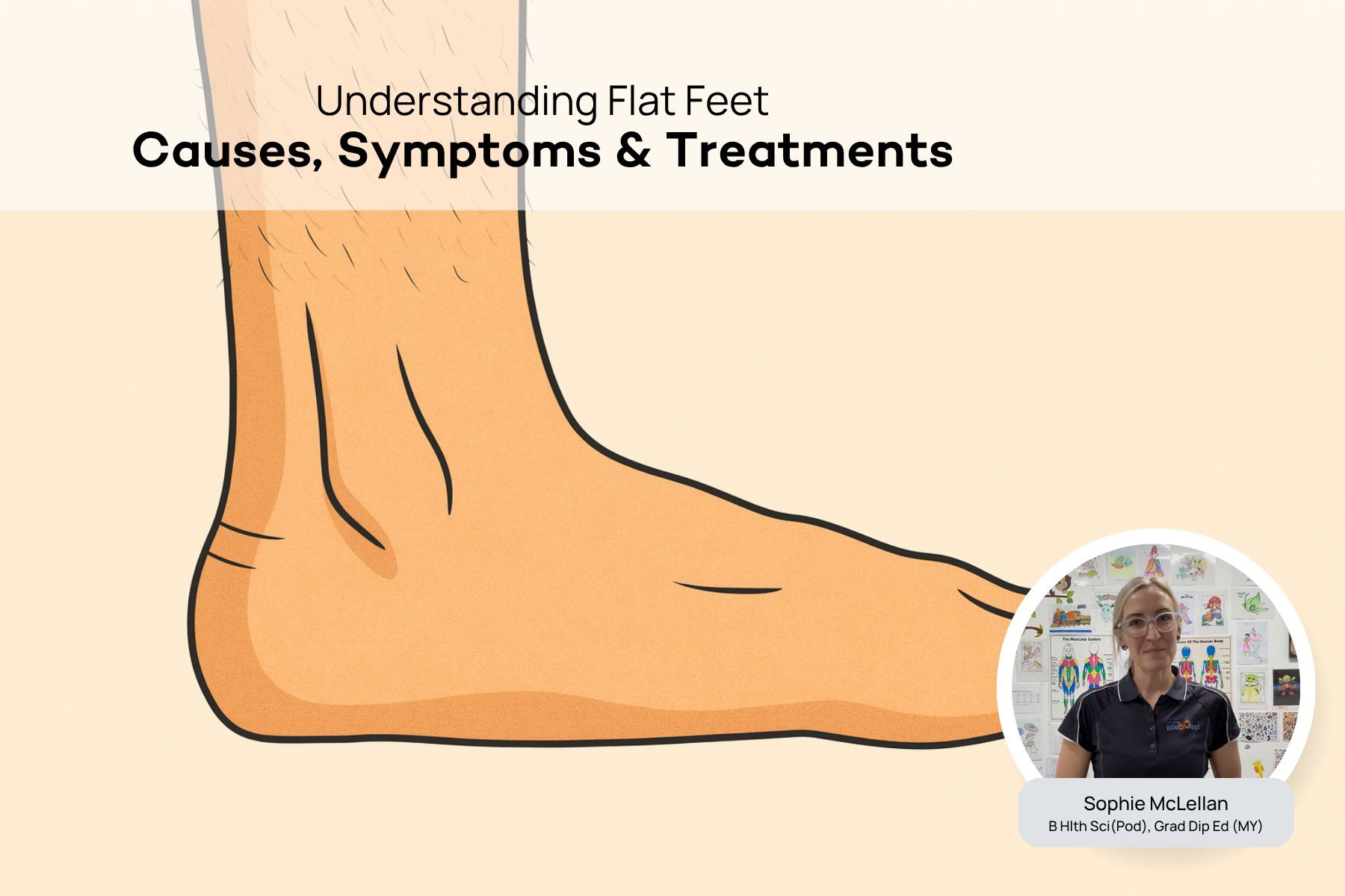Flat Feet Podiatry