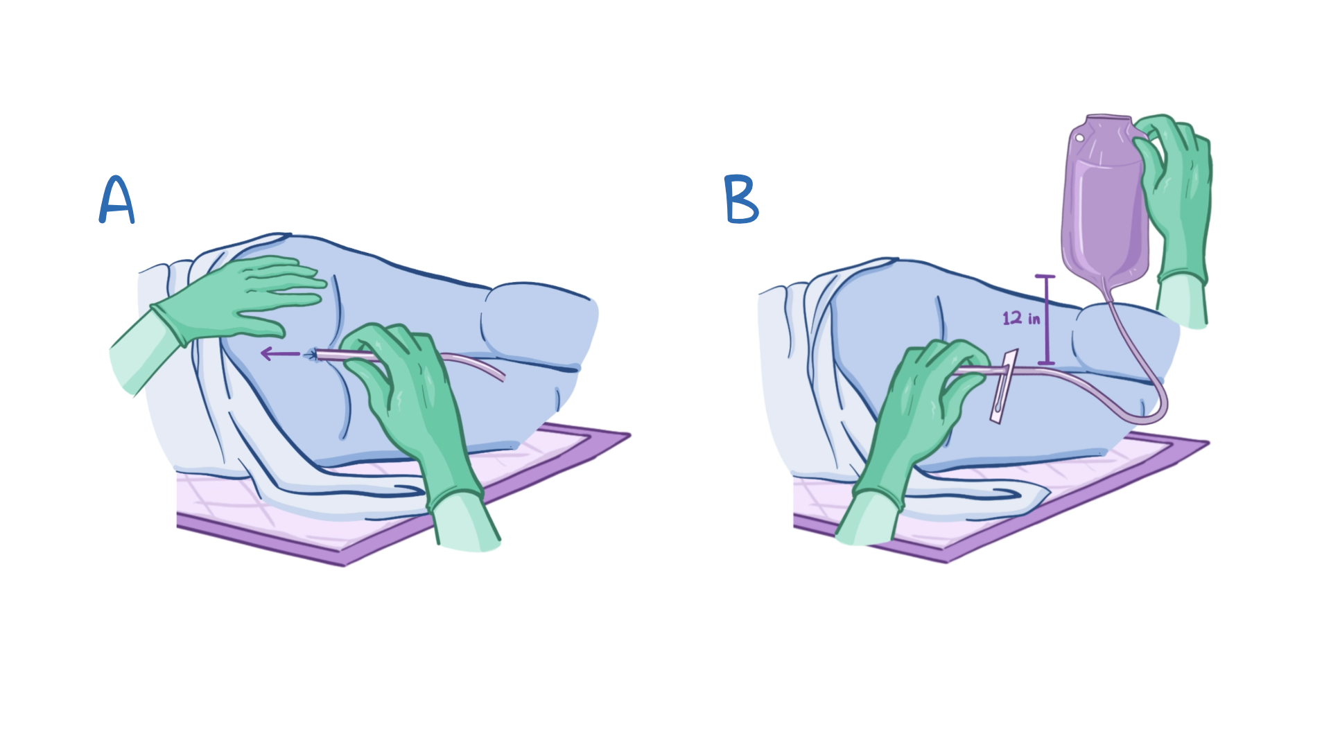 Fleet Enema How To Use