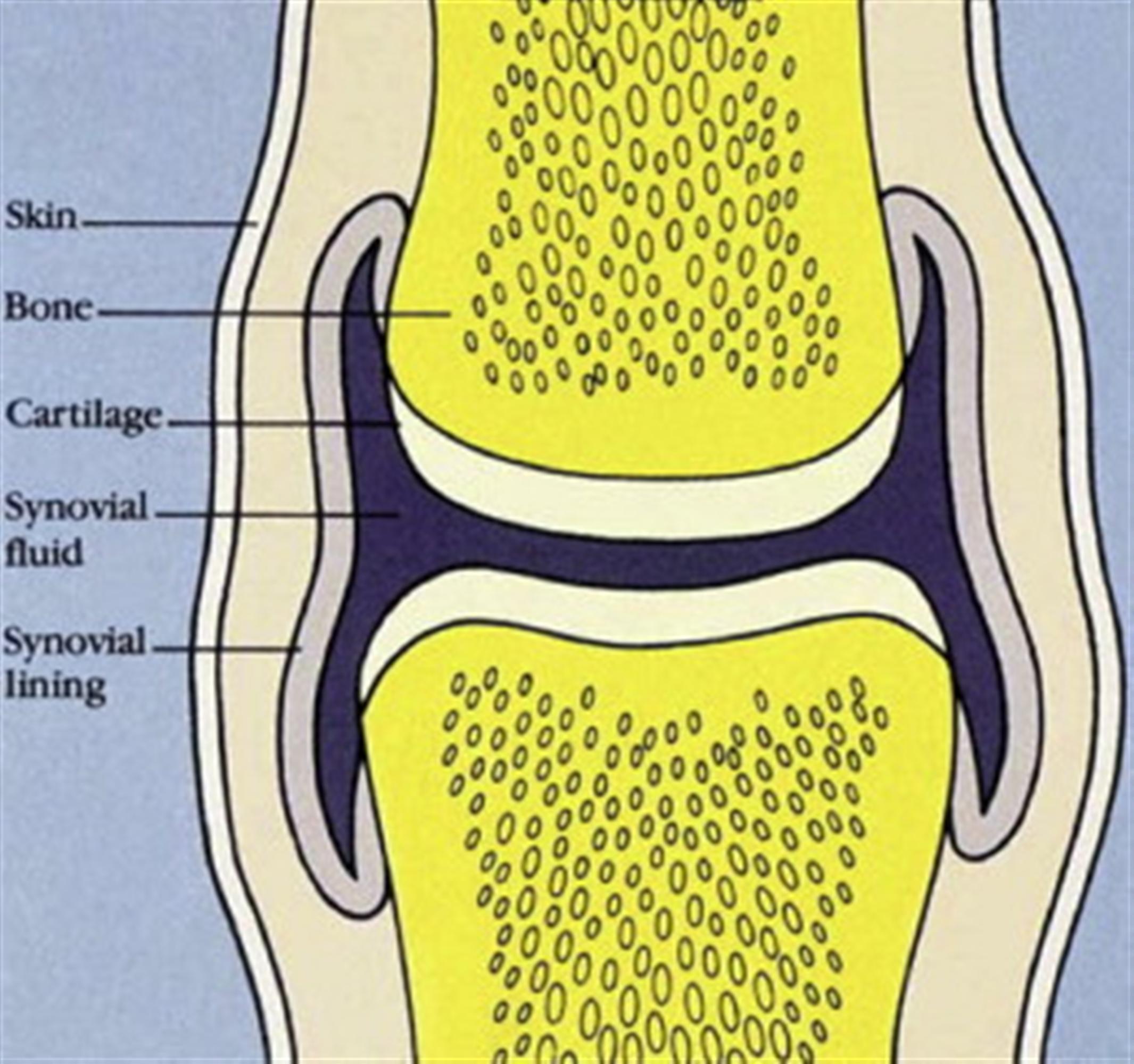 Fluid On The Knee