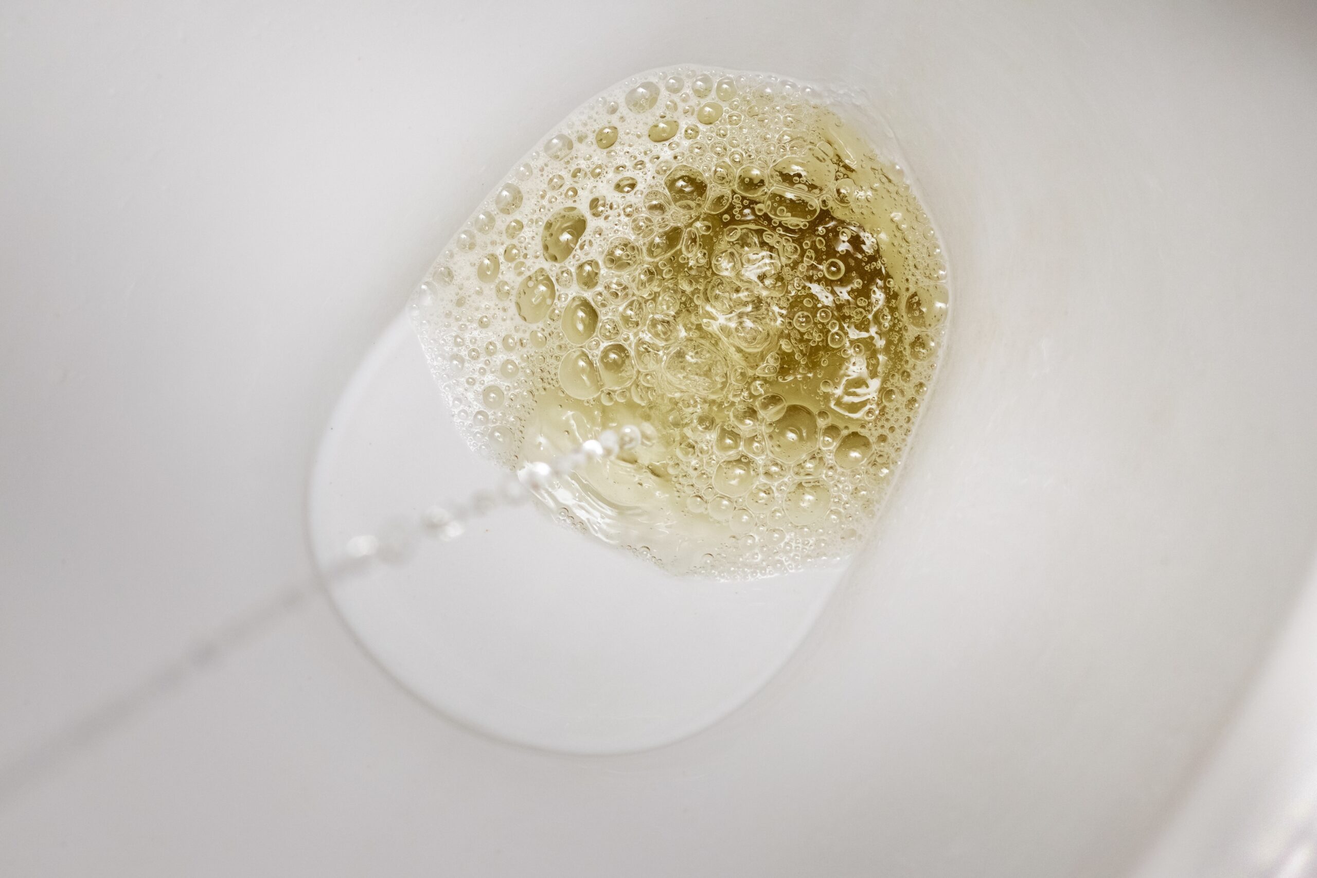 Foamy Urine In Men