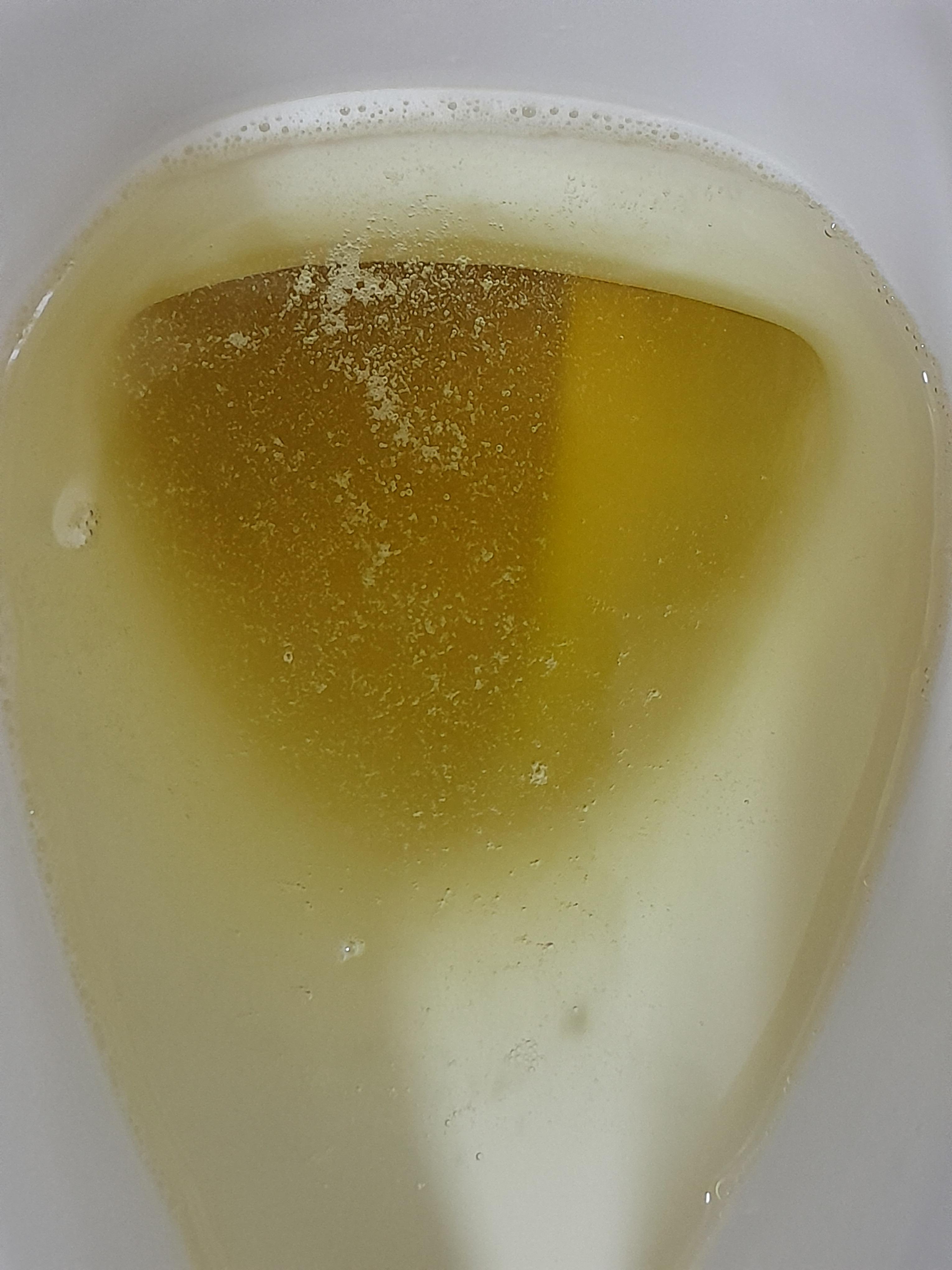 Foggy Looking Urine